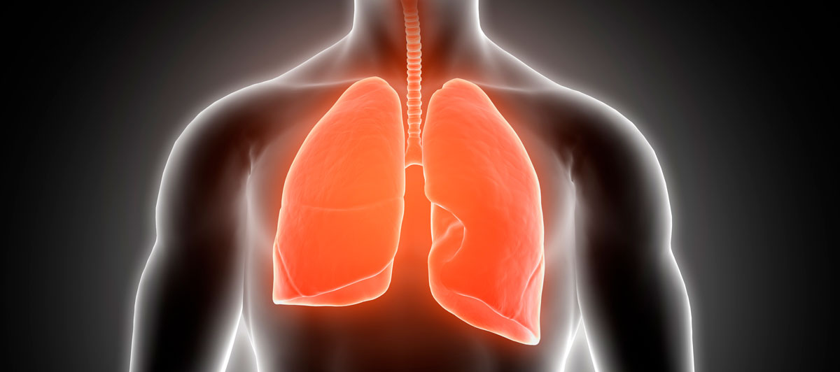 Brigatinib incrementó la SLP en CPCNP ALK + al compararse con crizotinib