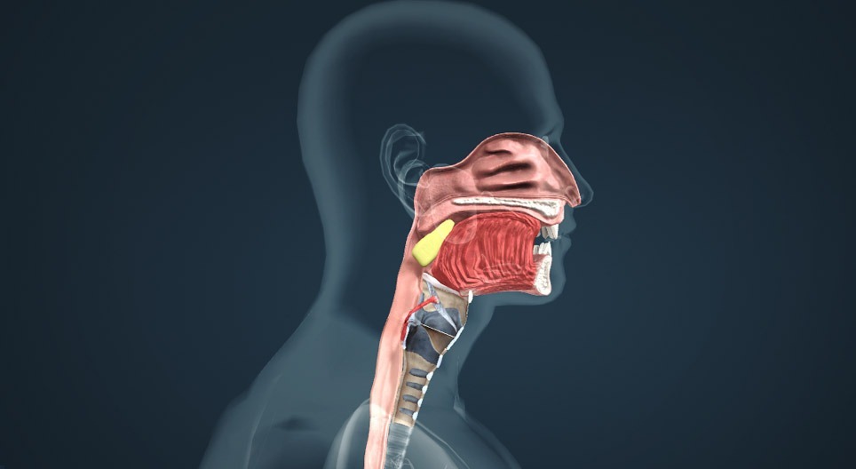 Resultados positivos con tislelizumab + QT en 1L para cáncer de nasofaringe recurrente o metastásico