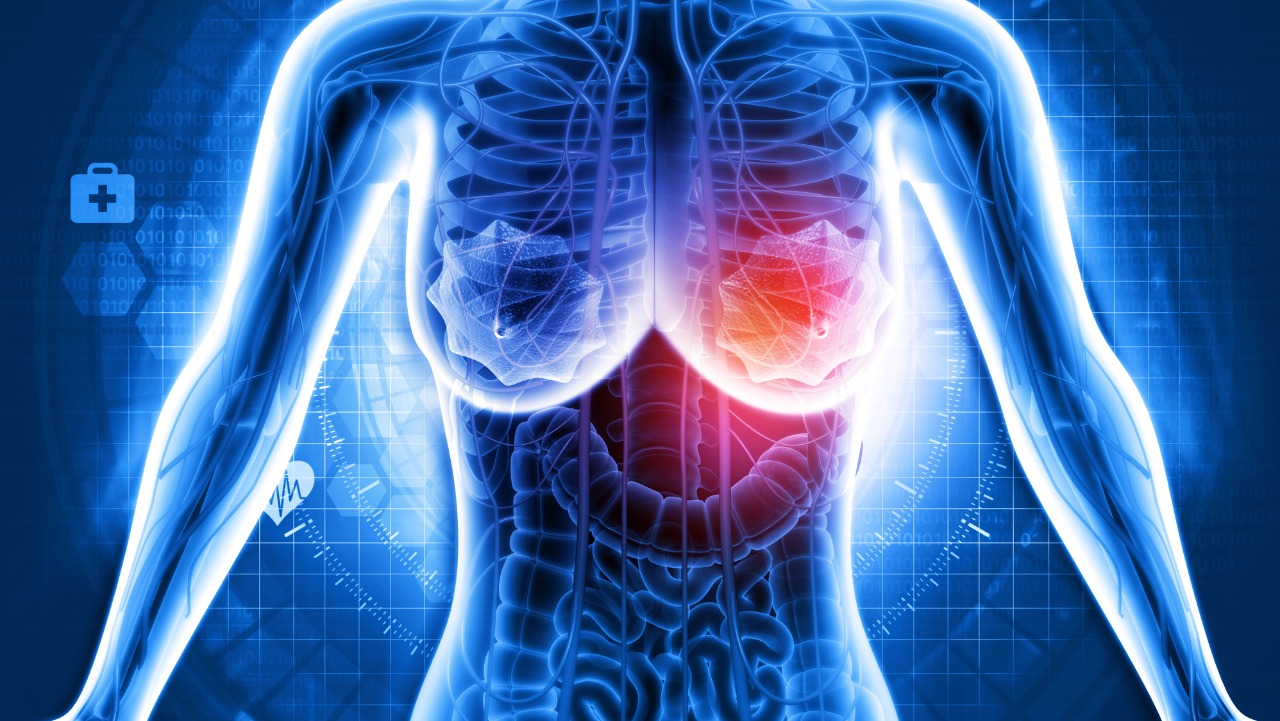 CMTN: Sacituzumab govitecan-hziy + pembrolizumab, nueva colaboración para estudio fase III