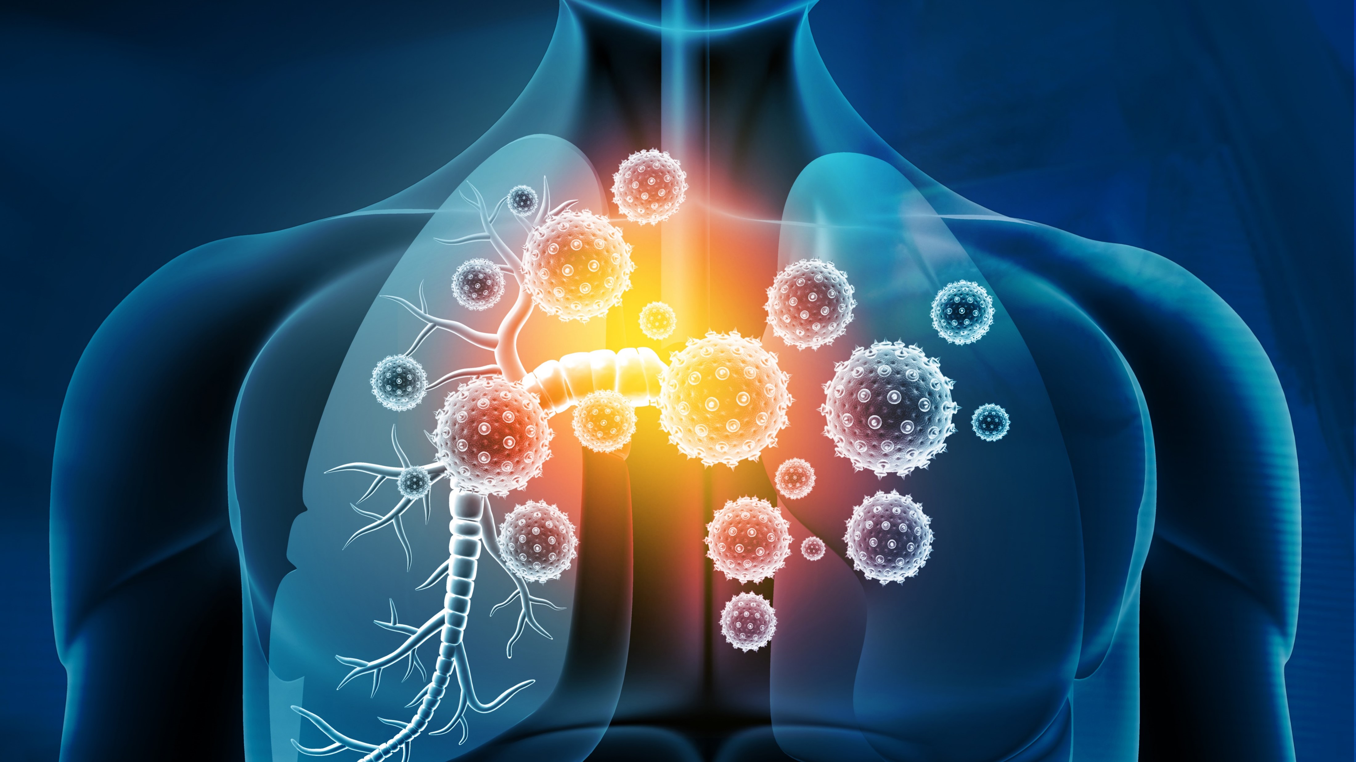 CPCNP: Nivolumab + QT mejoran significativamente la SLE, estudio CheckMate-816