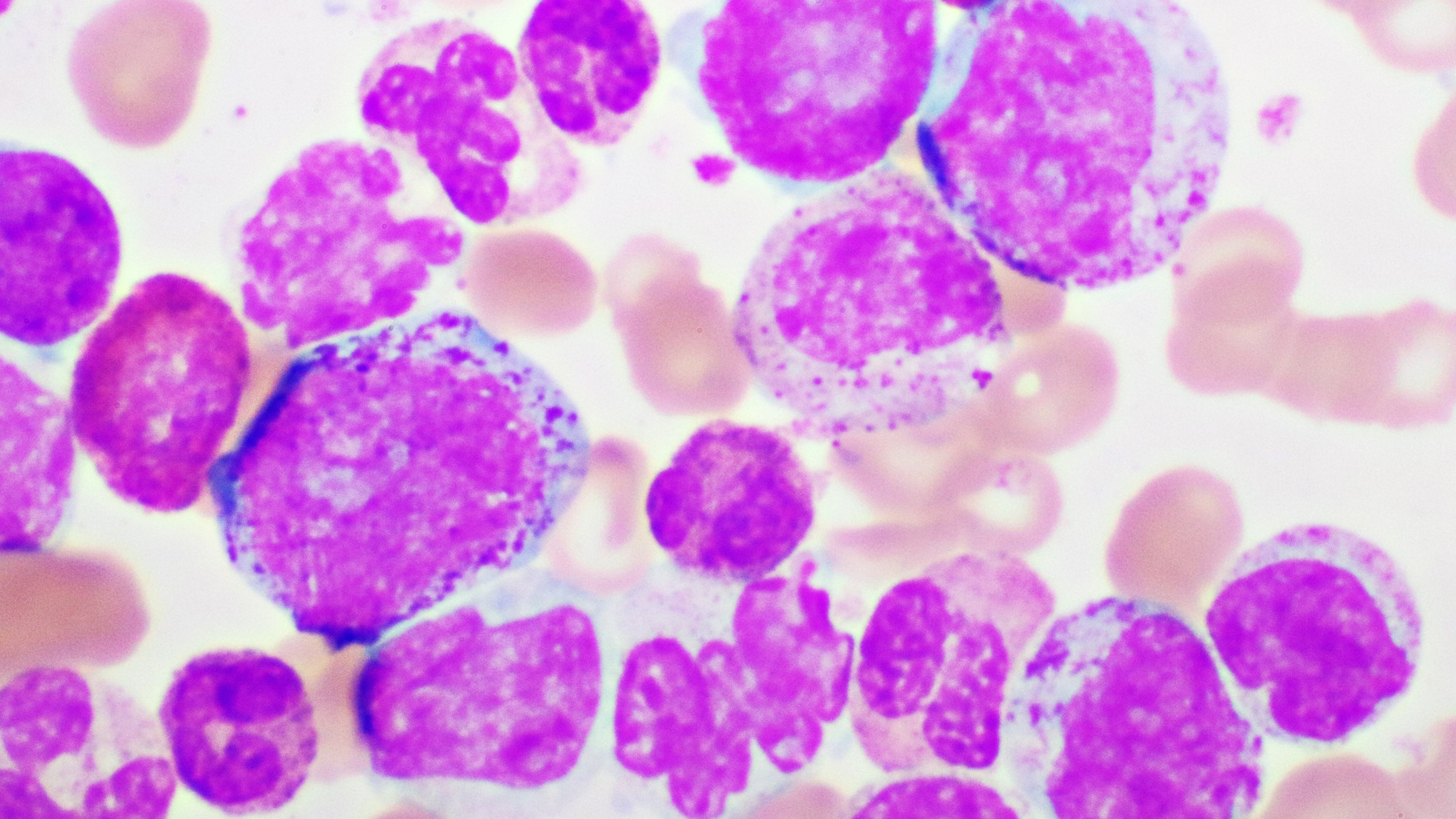 FDA aprueba asciminib para el tratamiento de la LMC