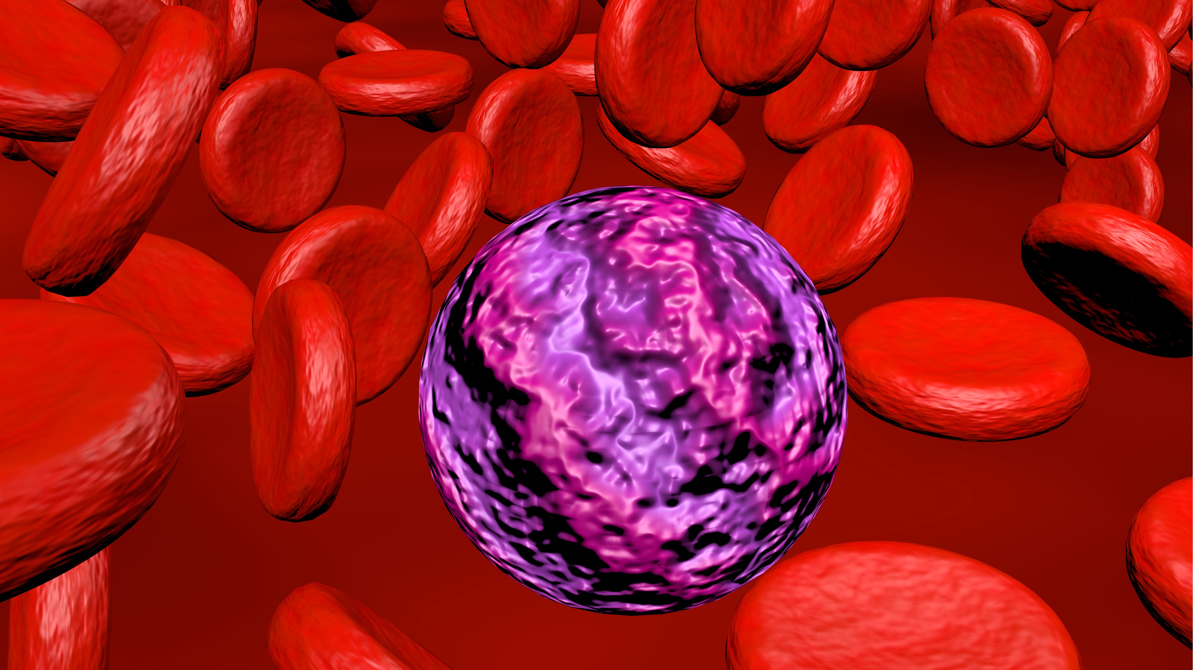 LMA: Combinación de quizartinib + QT mejoran SG vs. QT sola, estudio QuANTUM-First