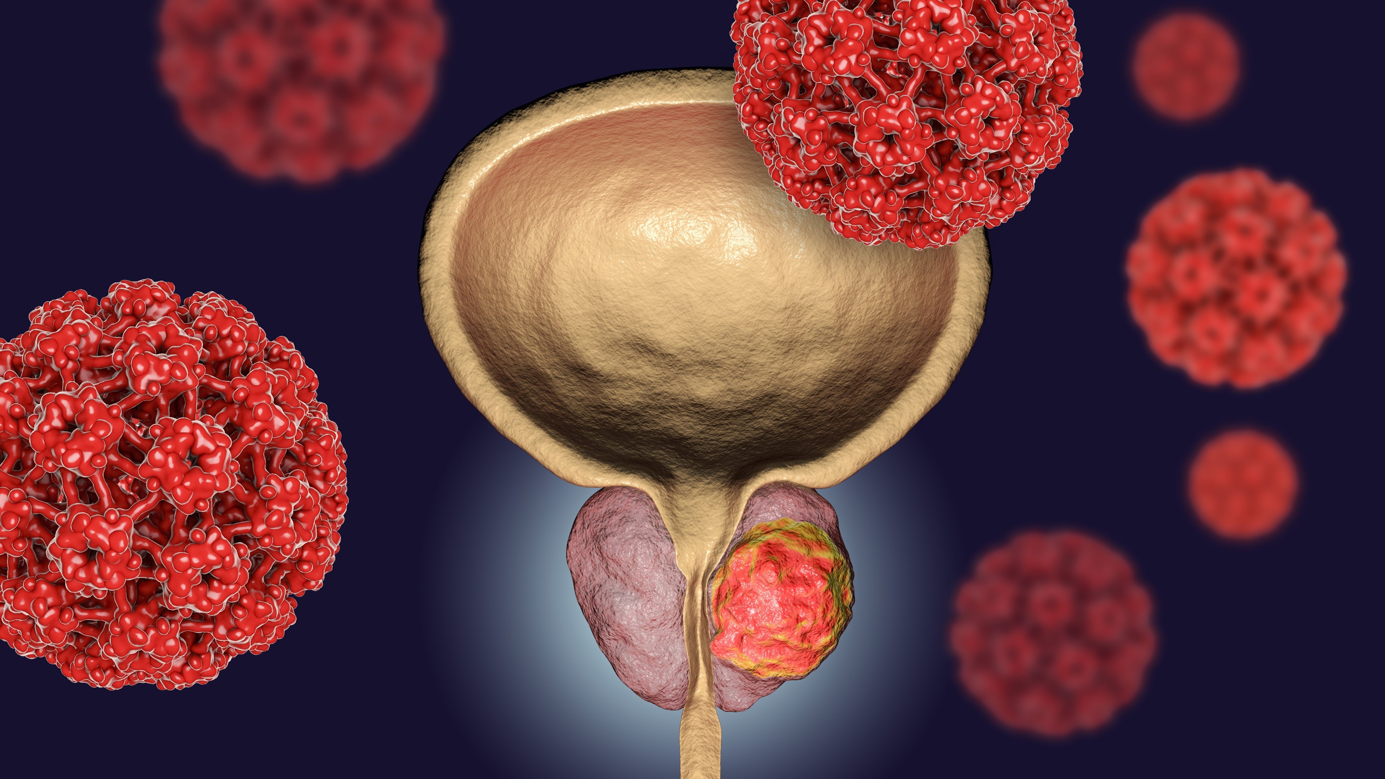FDA aprueba kit de diagnóstico por imágenes para el cáncer de próstata