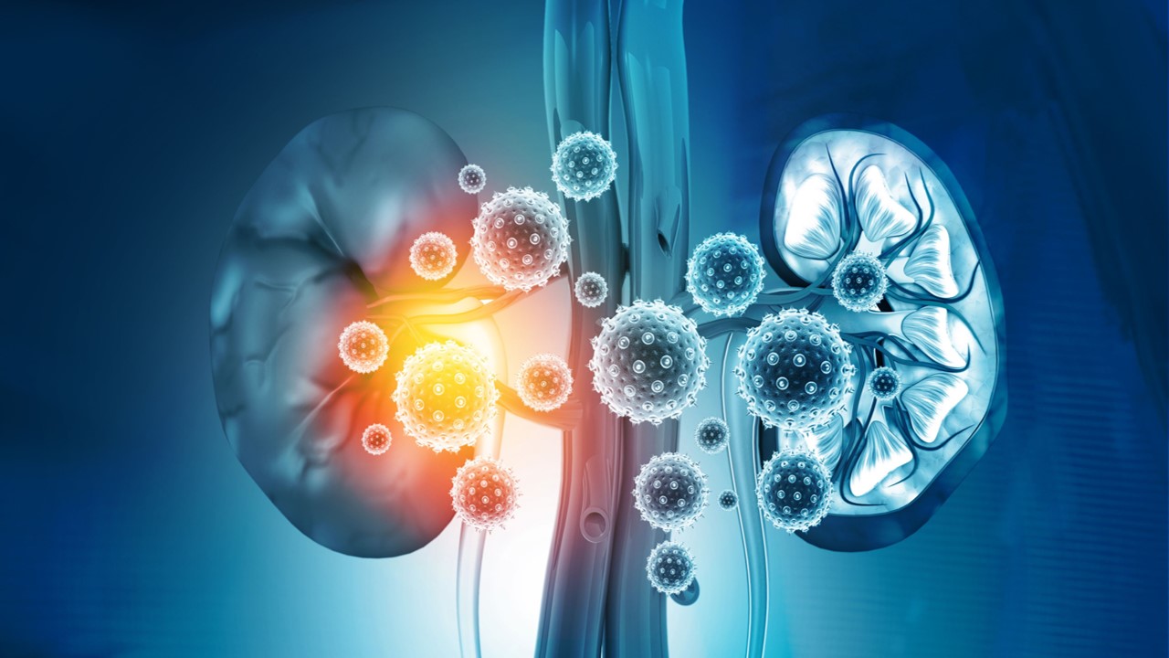 Comisión Europea otorga aprobación a pembrolizumab como monoterapia para CCR, estudio KEYNOTE-564