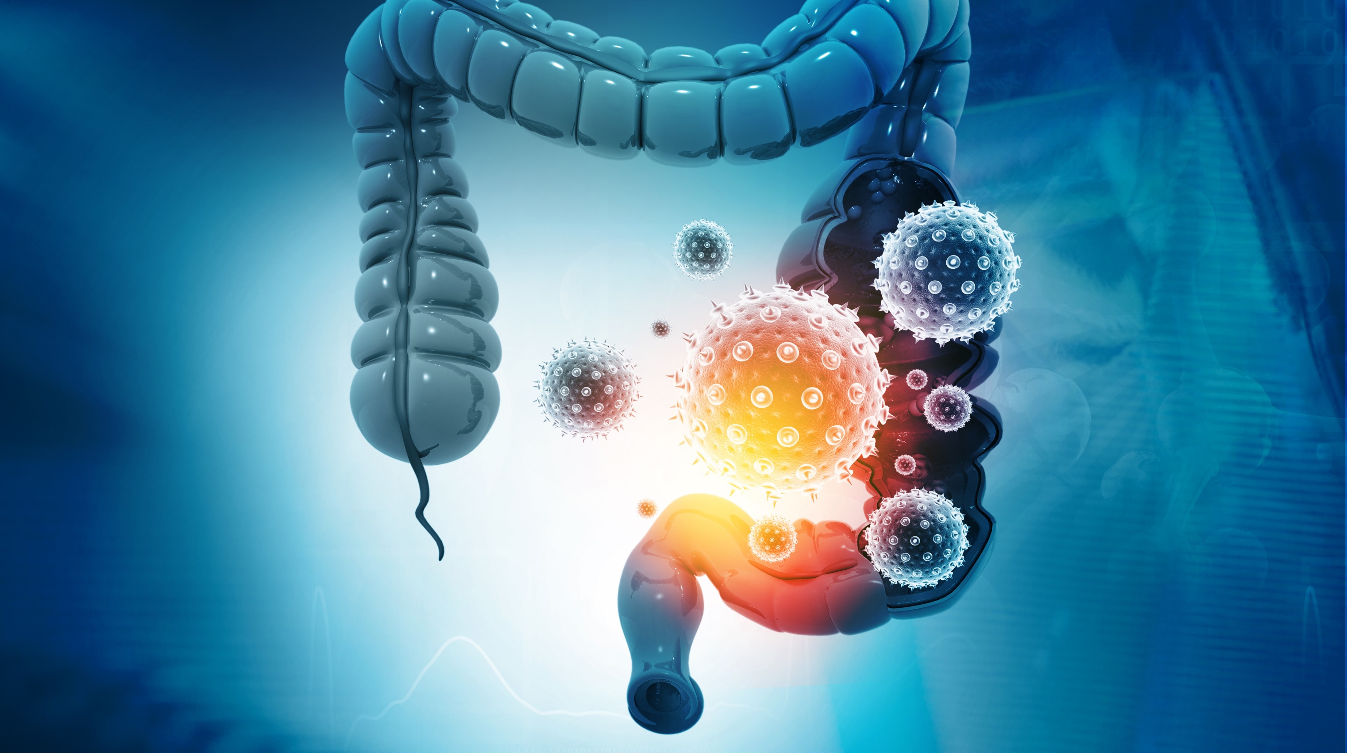 GIST: Resultados positivos del análisis de ctDNA con ripretinib en 2L con mutaciones en el gen KIT del exón 11 y 17/18, estudio INTRIGUE