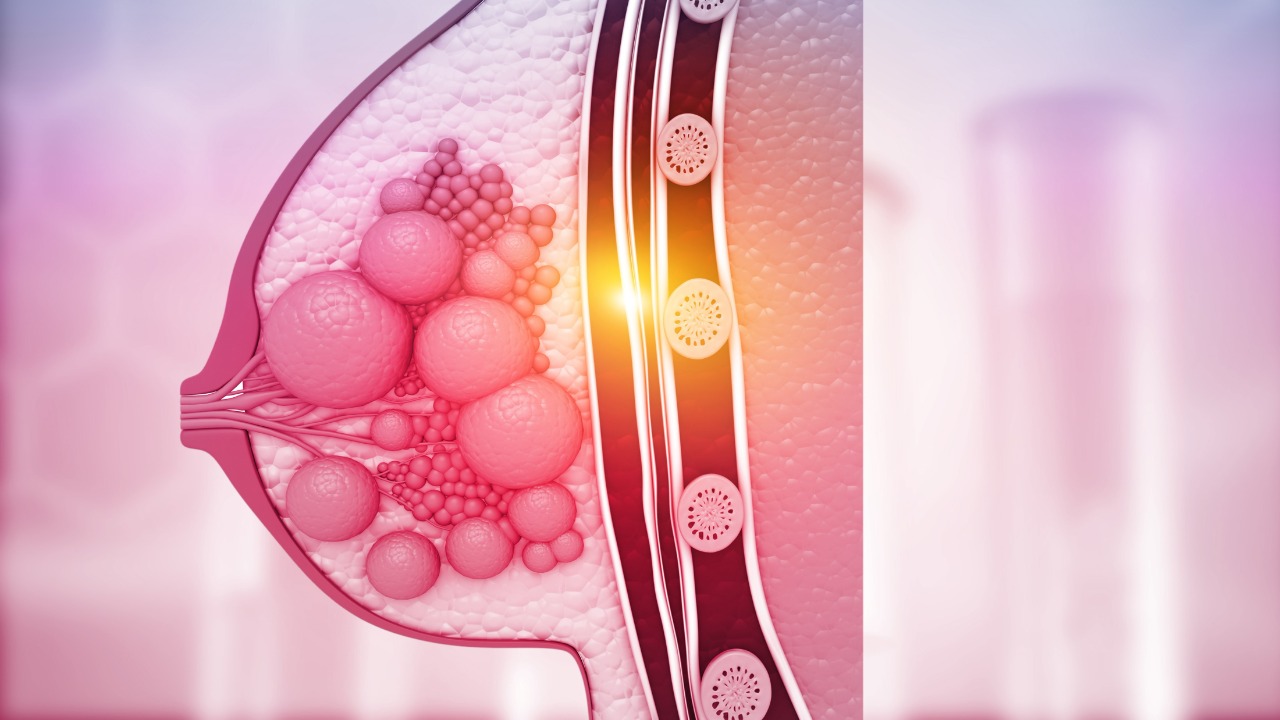 CMTN: La combinación de pembrolizumab neoadyuvante + QT demostraron una mejora en la SLE, estudio KEYNOTE-522