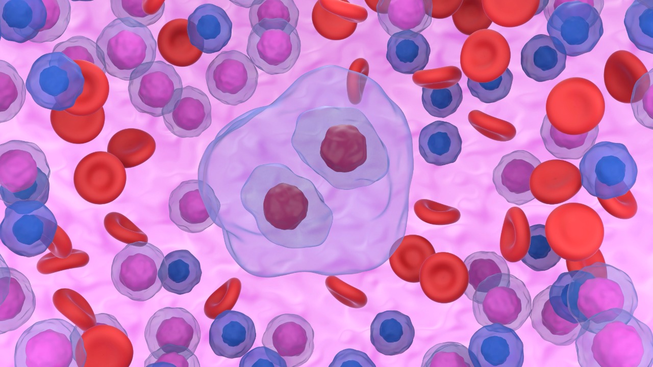 LHc avanzado: La combinación de brentuximab vedotin demostró una mejora significativa en la SG, estudio ECHELON-1