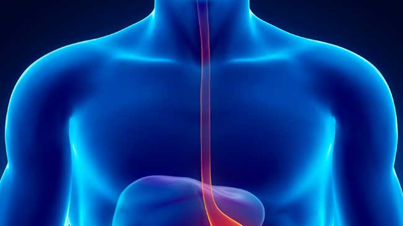 Cáncer de esófago avanzado: Tislelizumab + QT mejoró significativamente la SG en 1L, estudio RATIONALE 306