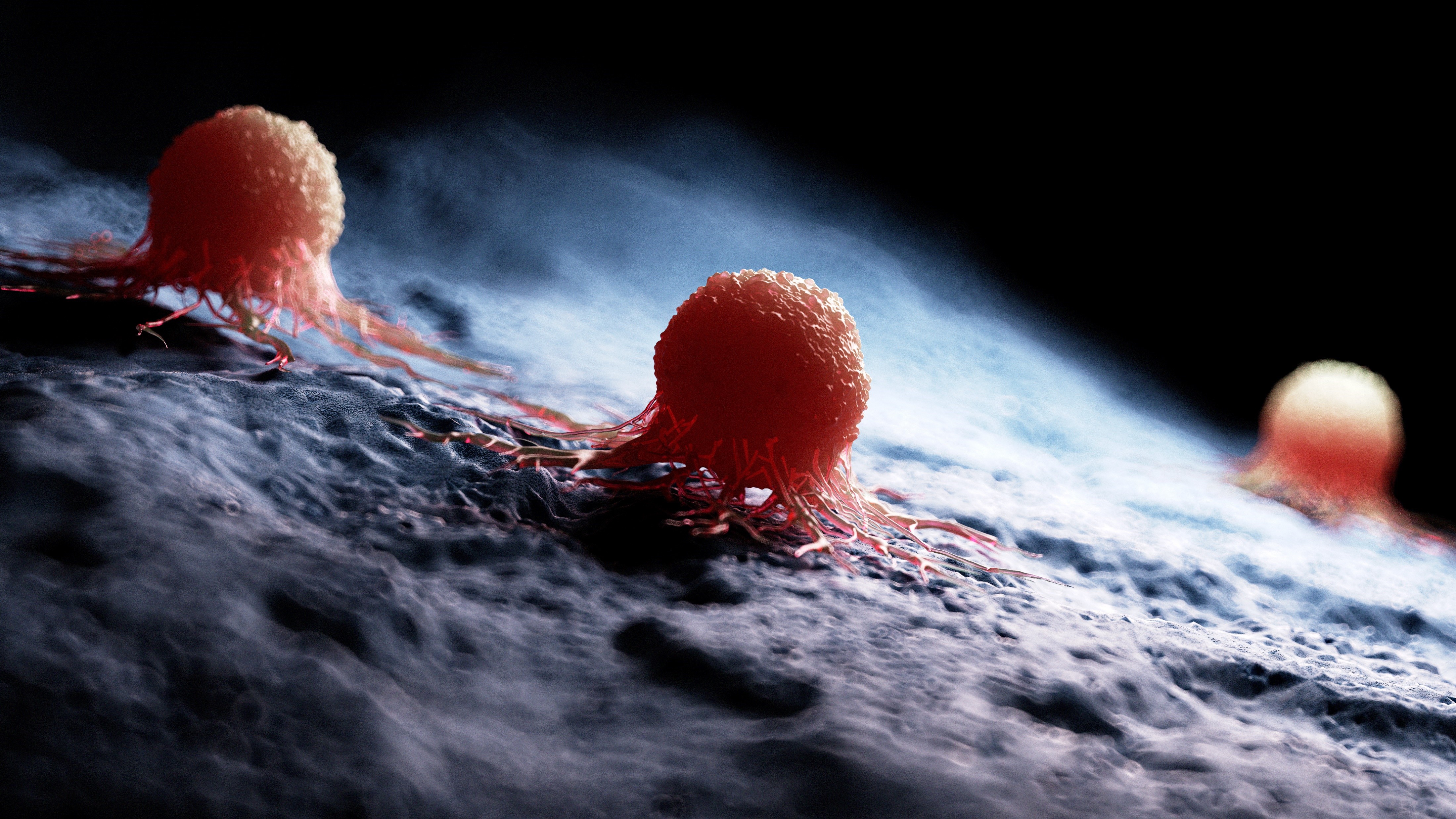 Tumores con MSI-H/dMMR: Pembrolizumab aprobado en Europa como 2L o posteriores en cinco tipos diferentes de tumores sólidos