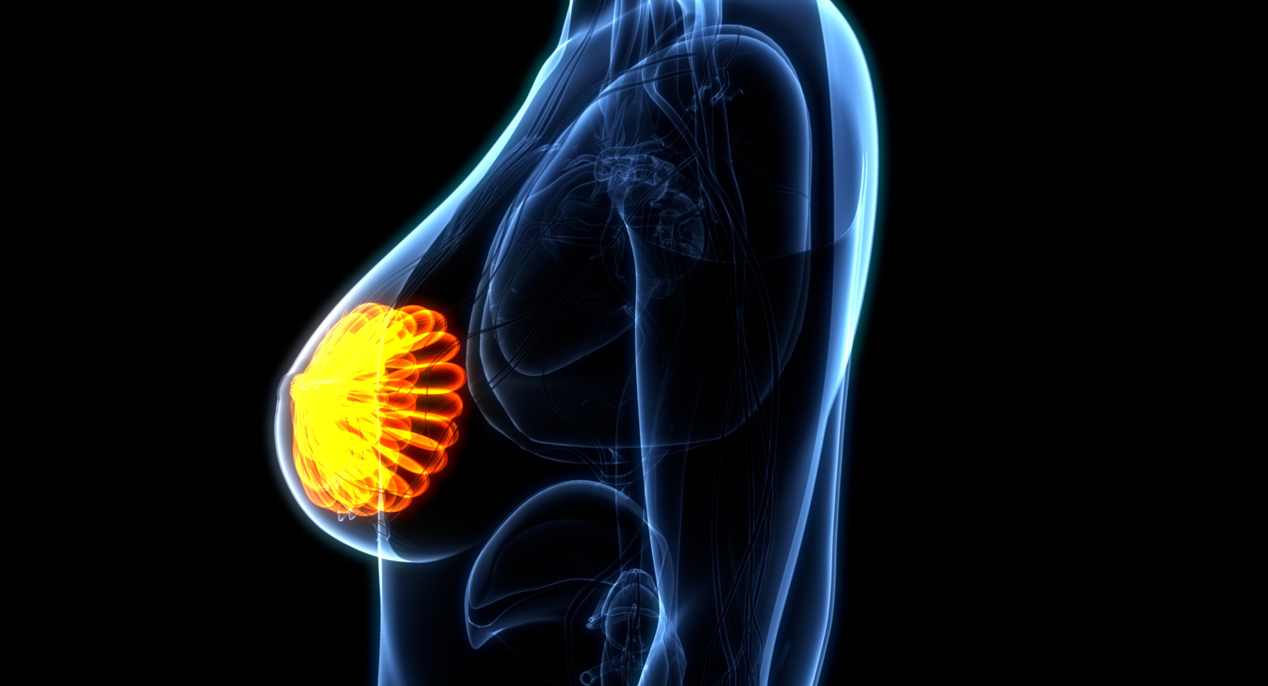 CMM HER2-bajo: Trastuzumab deruxtecan obtuvo la designación de terapia innovadora
