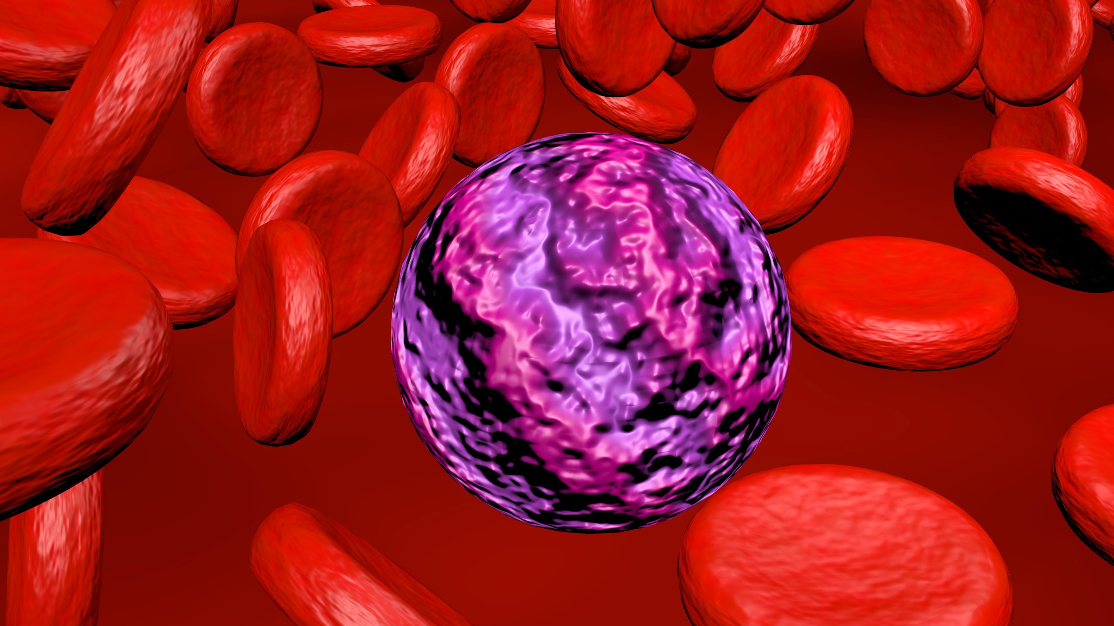 LMA con mutación IDH1: FDA aprueba ivosidenib + azacitidina, estudio AGILE