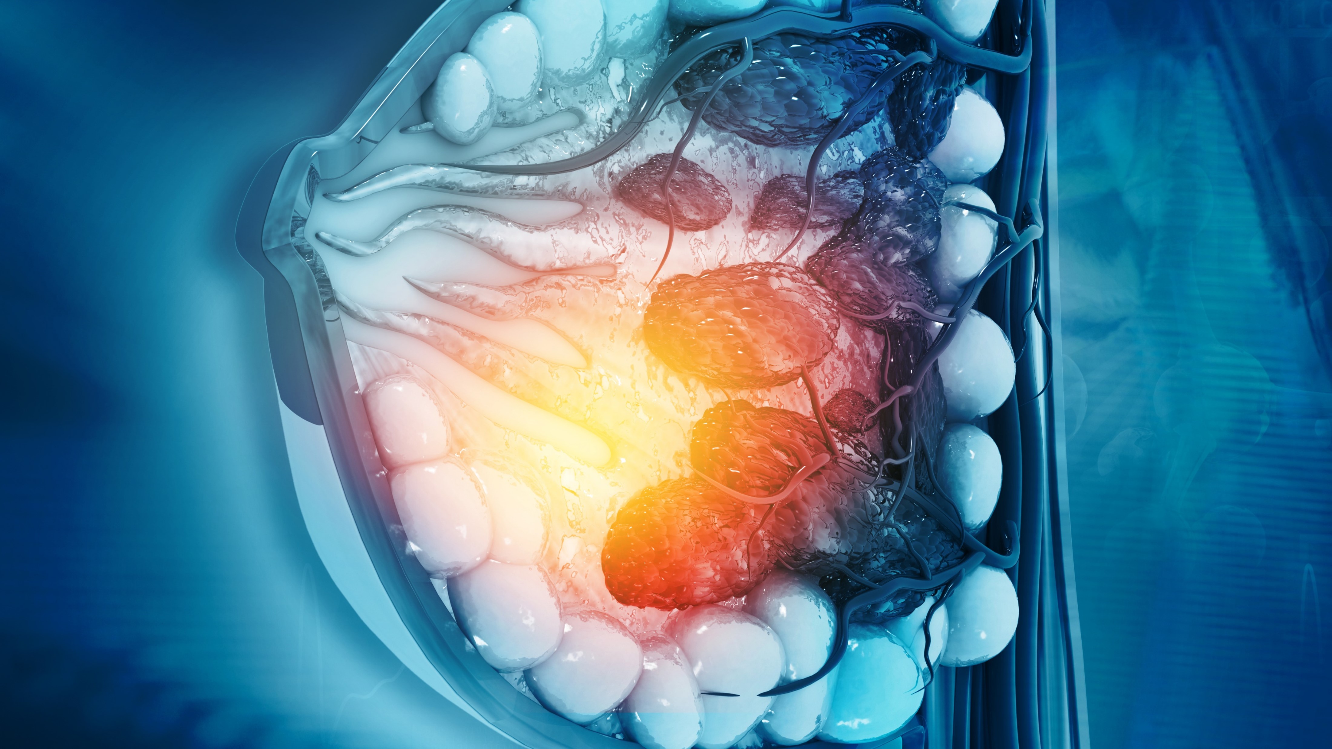 CMTN avanzado con expresión de PD-L1: Pembrolizumab + QT mejoran la SG, estudio KEYNOTE-355