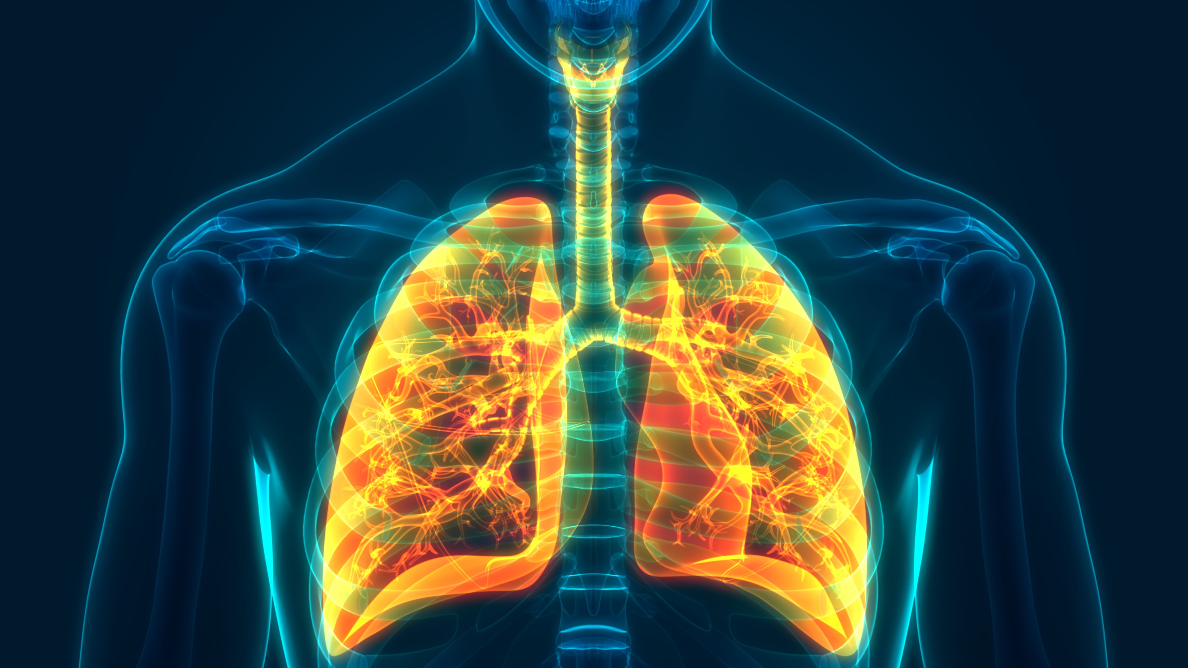 CPCNP: Consolidación de nivolumab + ipilimumab o nivolumab solo para pacientes en estadio III irresecable