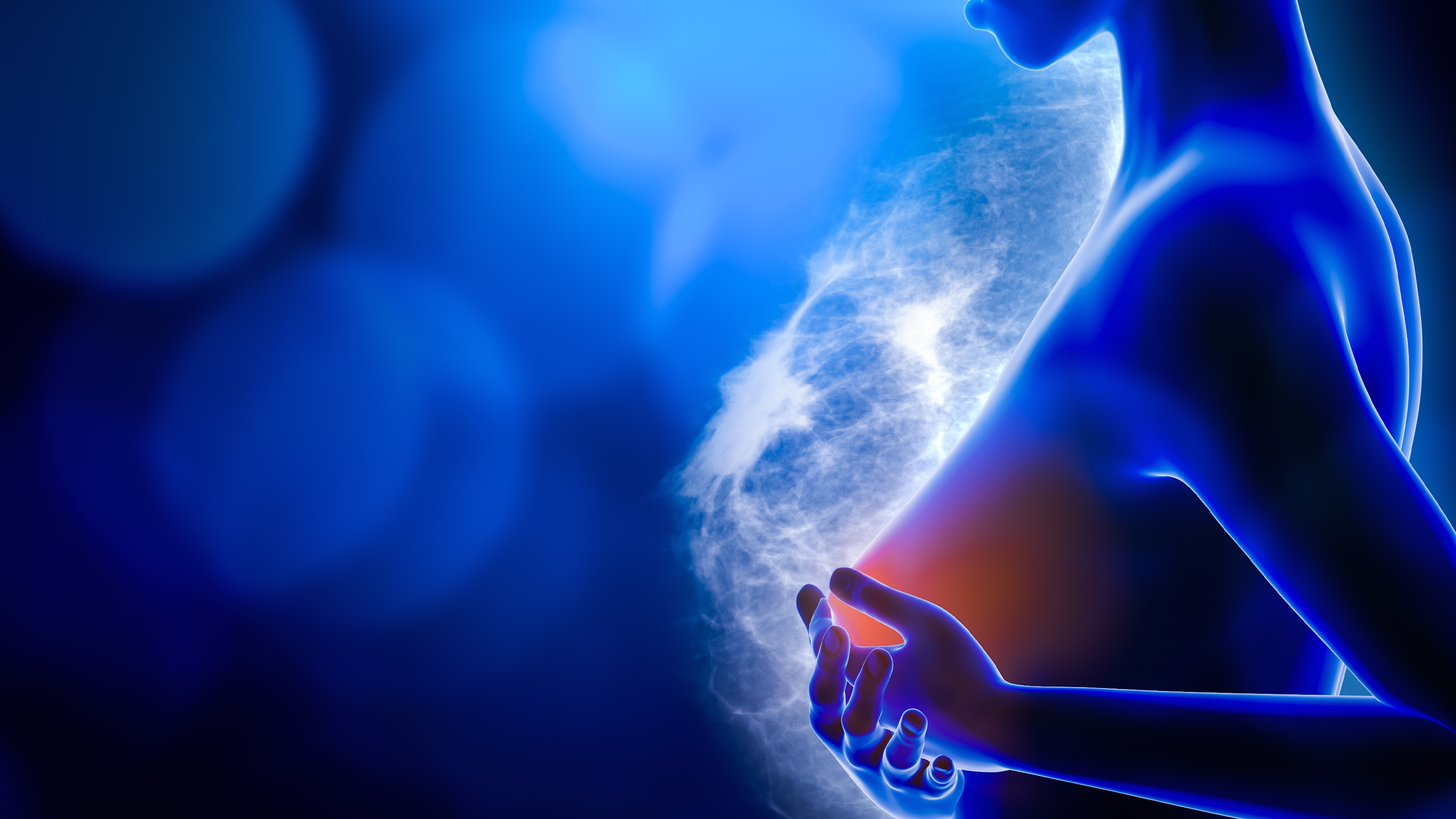 CMM RH+/HER2-: FDA acepta la revisión prioritaria de la solicitud de sacituzumab govitecan