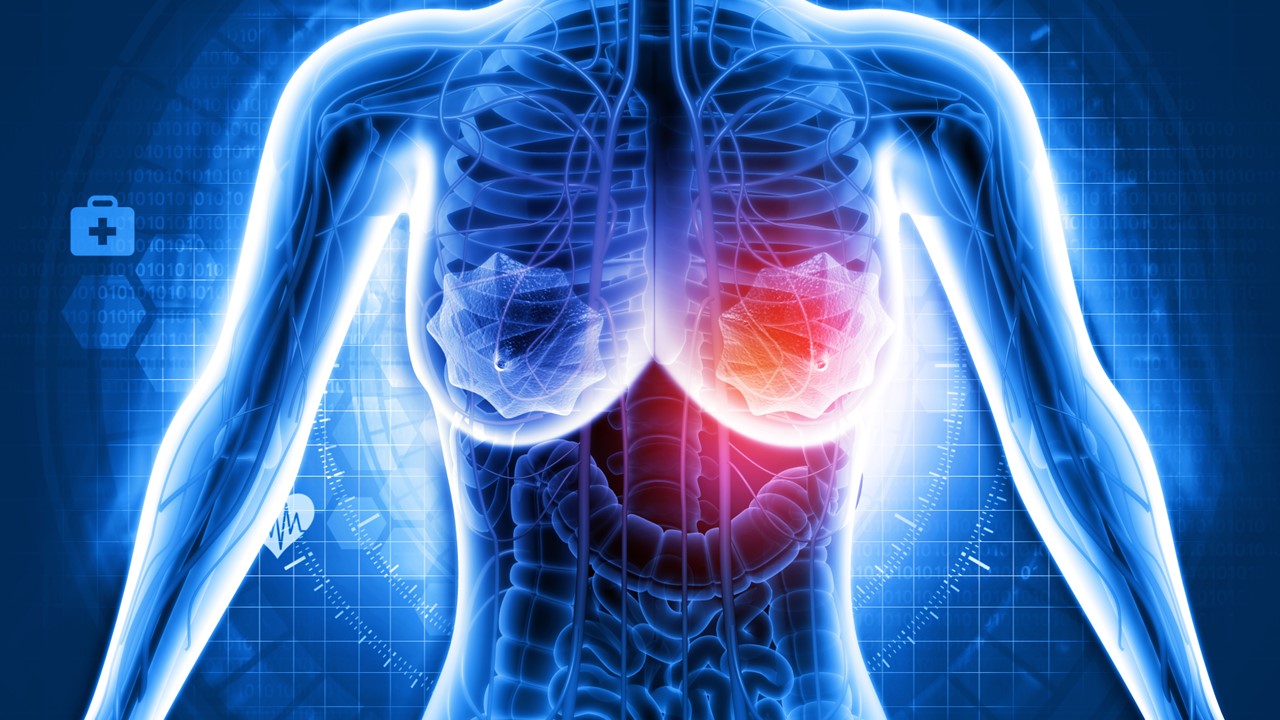 Ca. de mama RE+, HER2-: Elacestrant mostró un aumento en SLP, estudio EMERALD