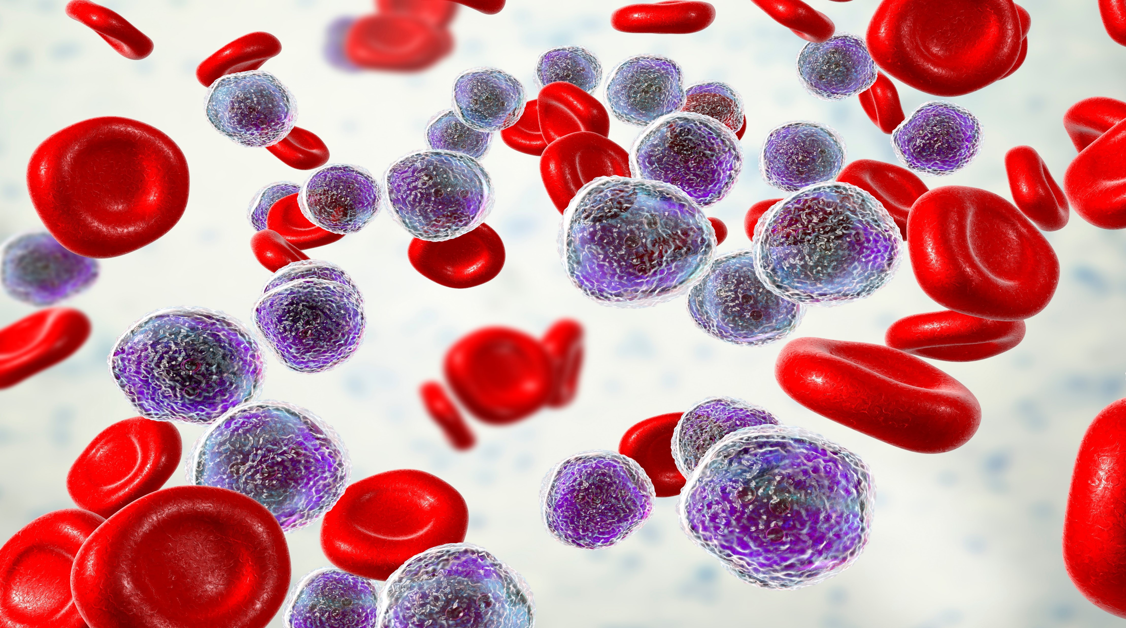 LLA Ph+: Ponatinib + QT de intensidad reducida logran resultados favorables, estudio PhALLCON