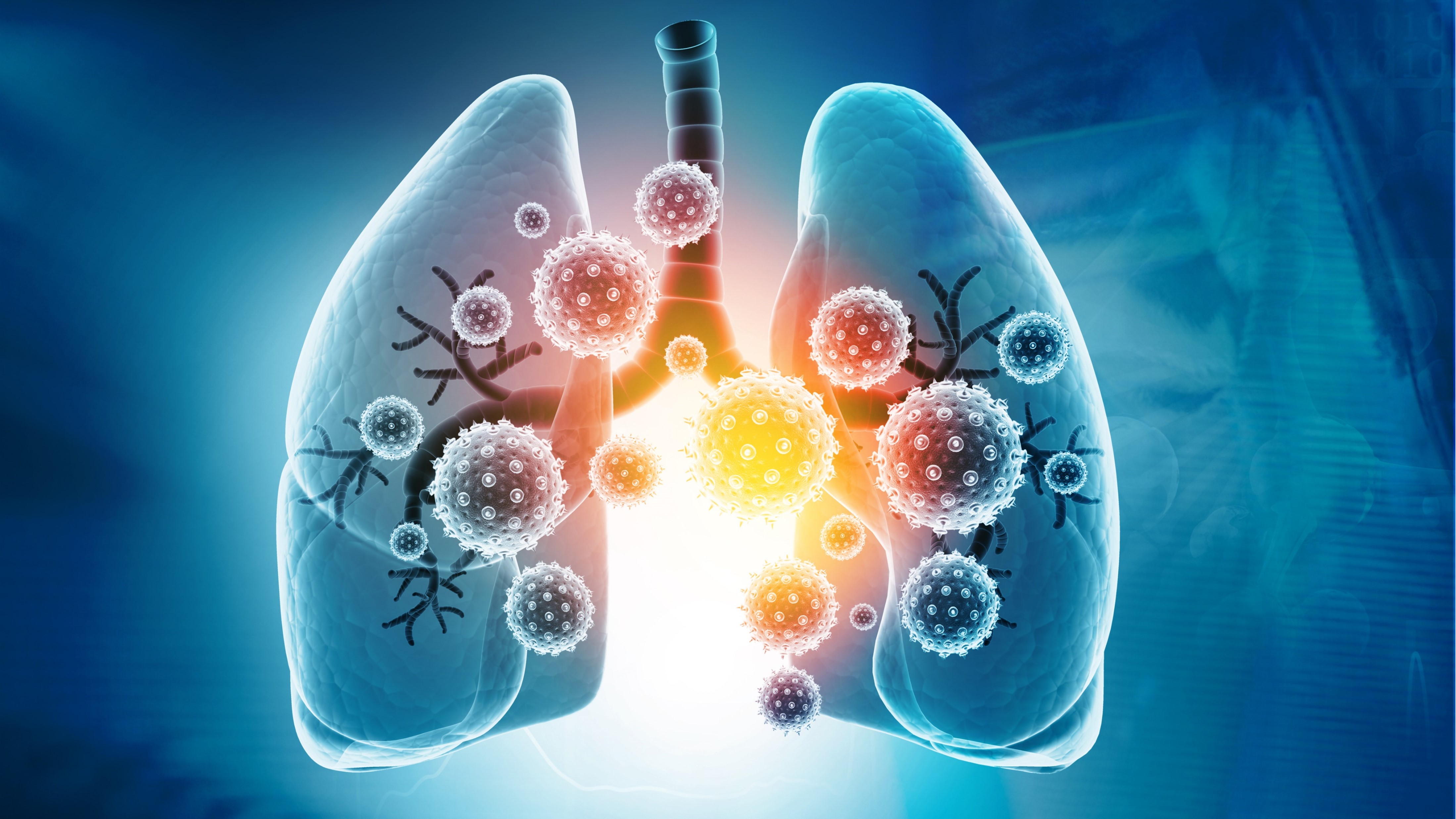 CPCNP: Durvalumab no logra significación estadística en SG vs. Qt en monoterapia, estudio PEARL
