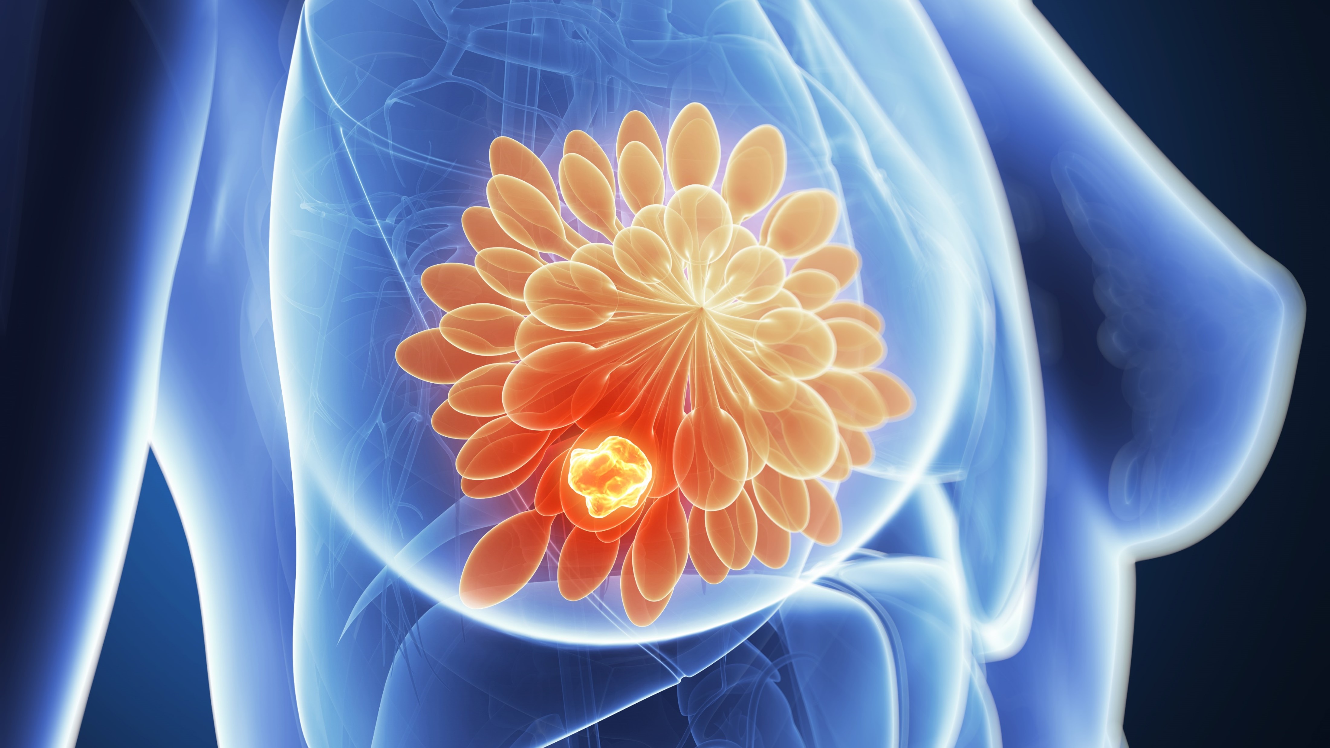 CMM RE+, HER2- y ESR1m: FDA aprueba elacestrant