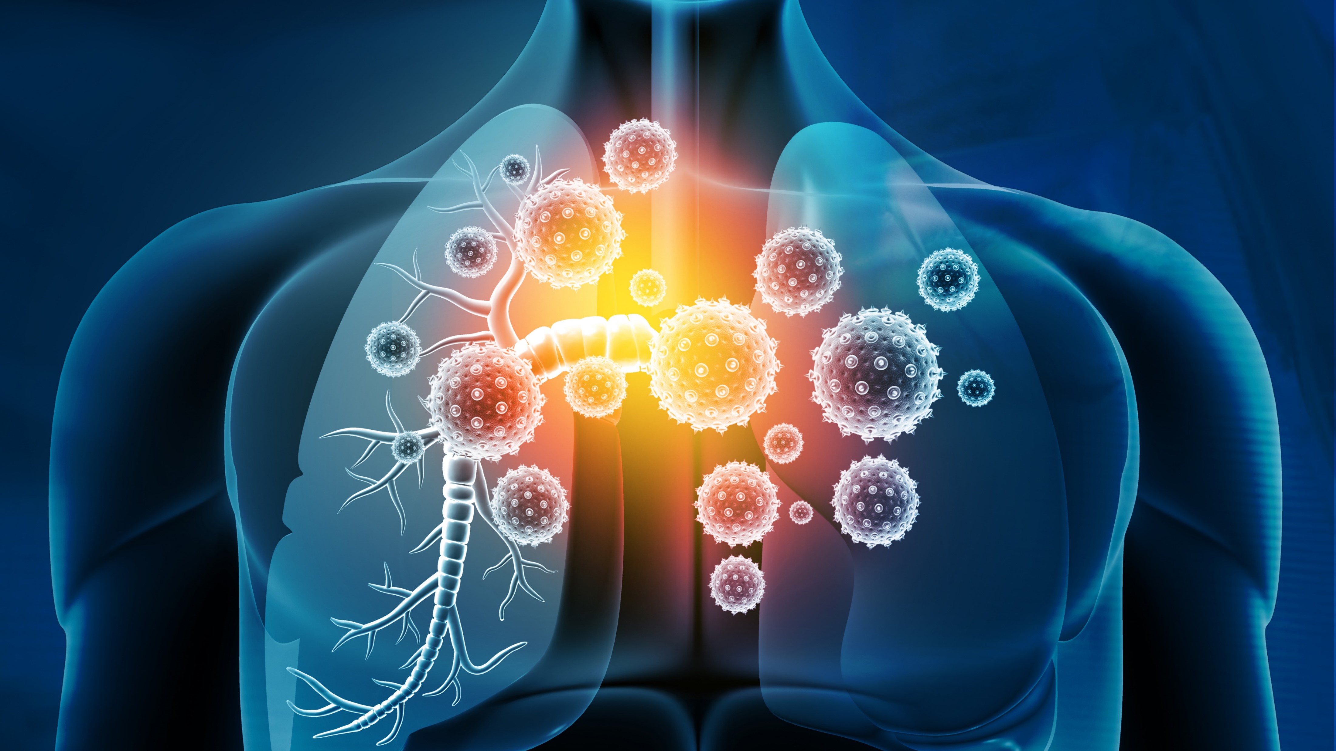 CPCNP: FDA aprueba pembrolizumab adyuvante
