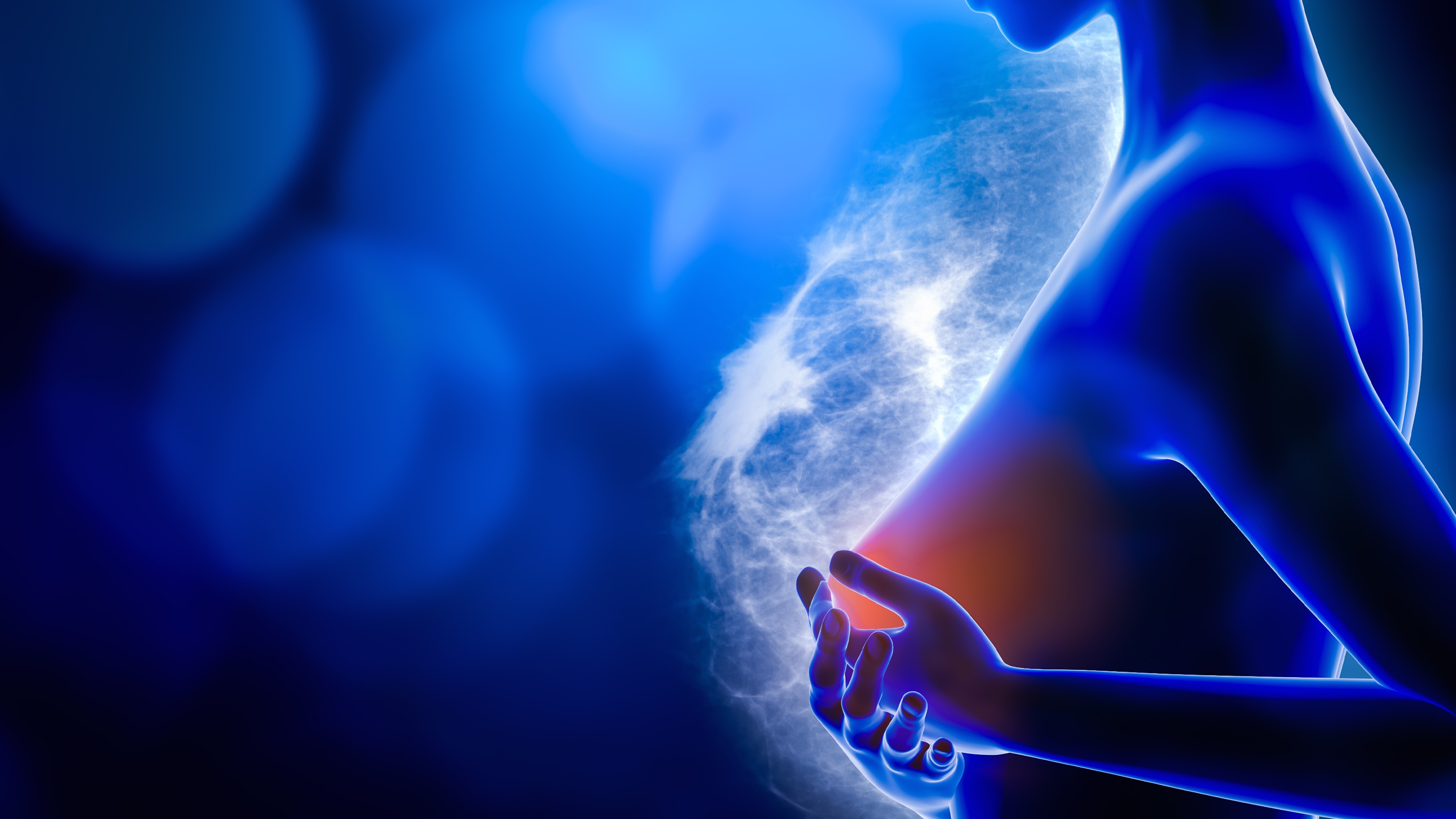 Ca. de mama temprano RH+/HER2-: Ribociclib demuestra beneficios clínicamente significativos, estudio NATALEE