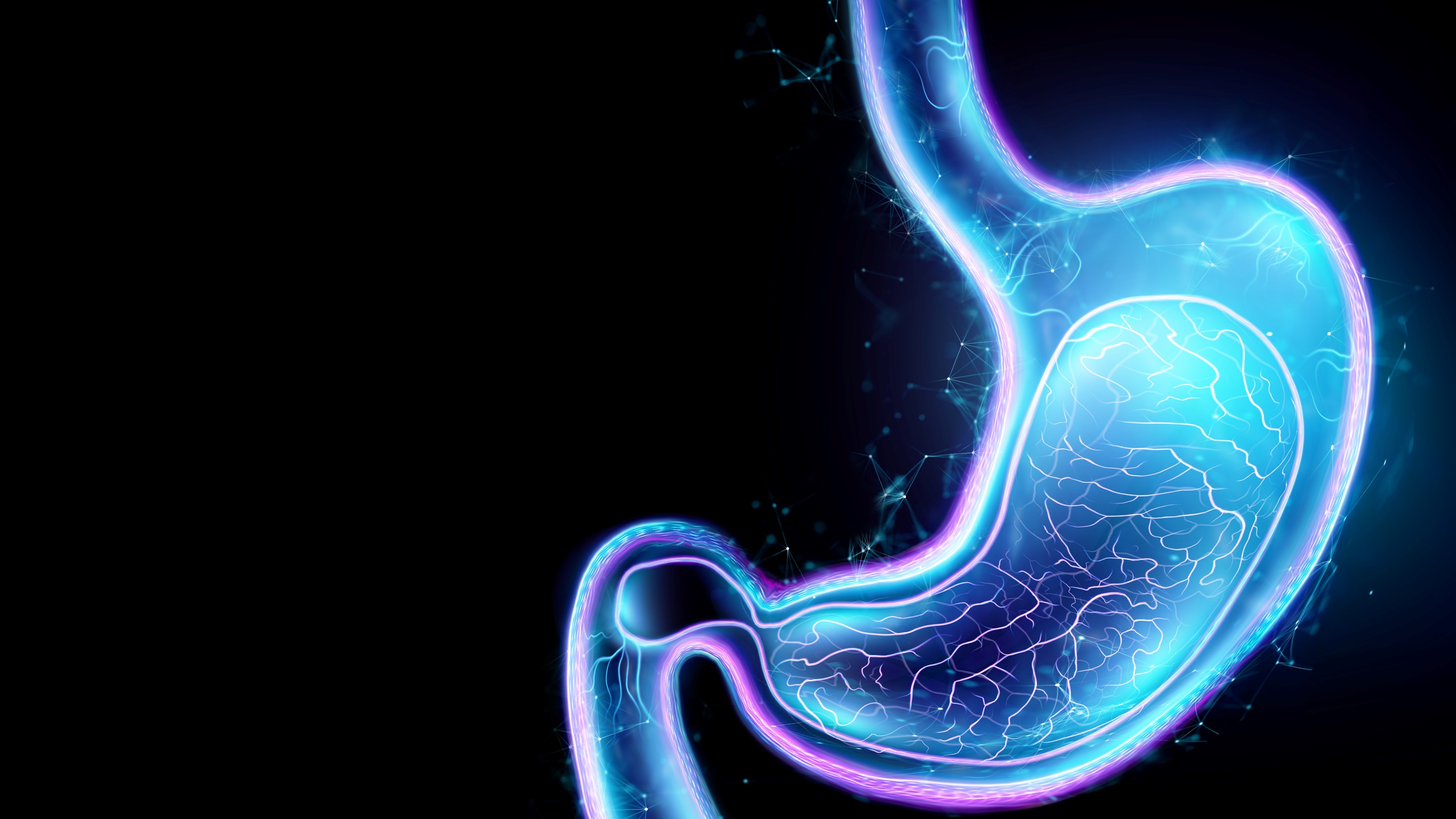 Adenocarcinoma gástrico o de la unión gastroesofágica HER2-: resultados positivos en SLP y SG con zolbetuximab