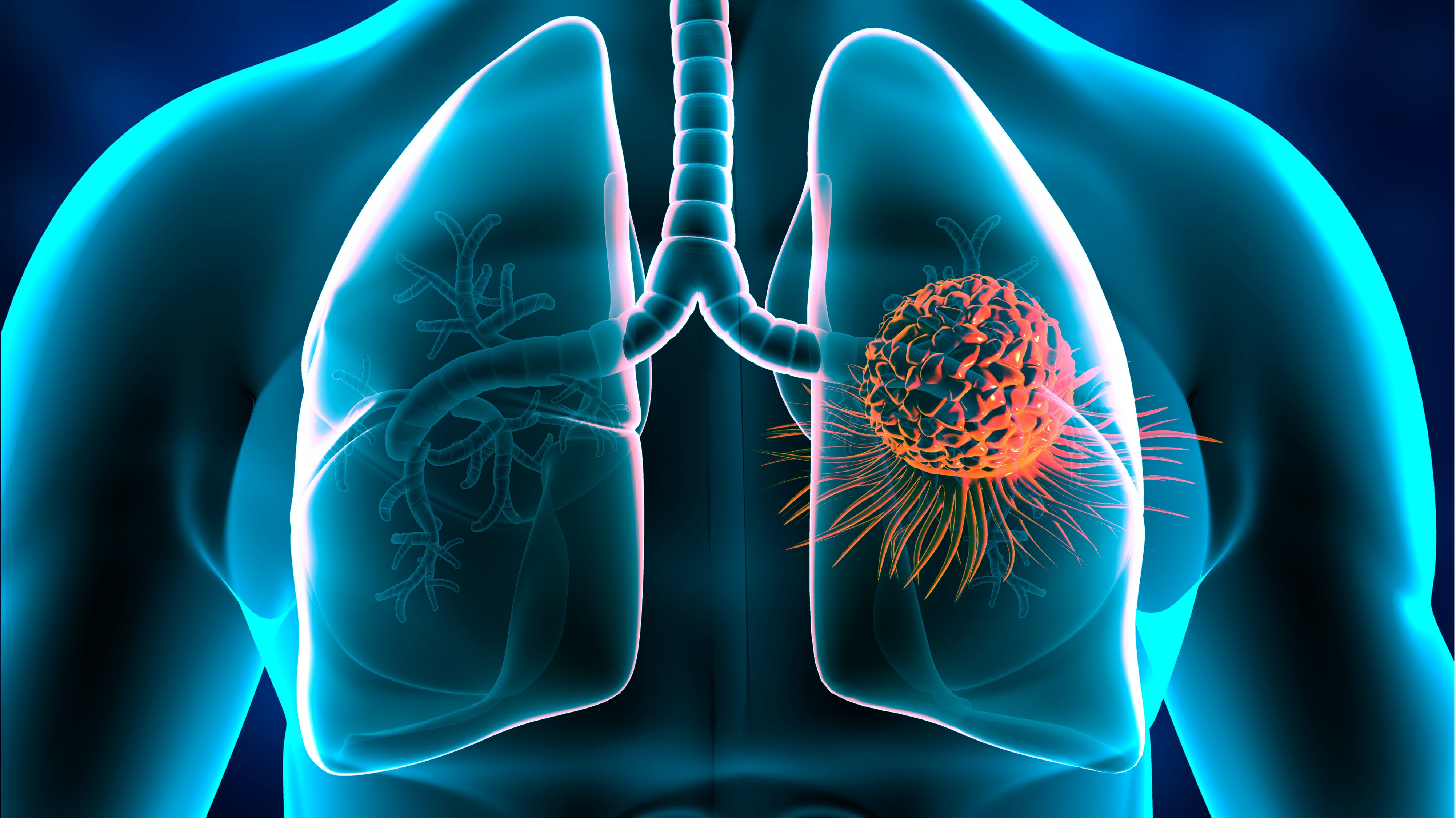 CPCNP: Sintilimab + QT, con o sin bevacizumab, demostraron beneficio en SLP en pacientes con histología no escamosa y EGFRm