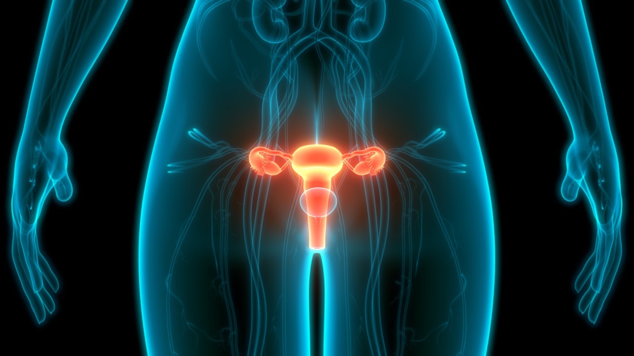 Ca. de cuello uterino localmente avanzado de alto riesgo: Pembrolizumab + QRT concurrente demuestran mejoras en SLP, estudio KEYNOTE-A18