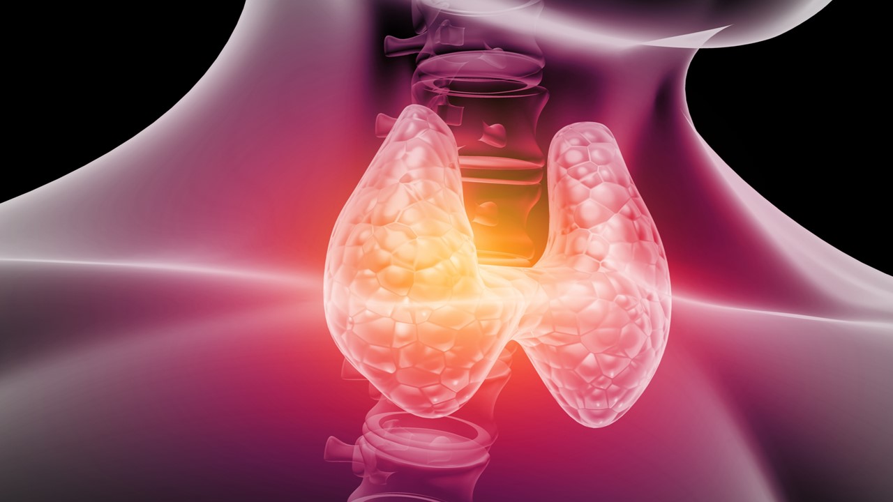 Cáncer medular de tiroides avanzando RET mutado: resultados positivos con selpercatinib vs. inhibidores multiquinasas, estudio LIBRETTO-531