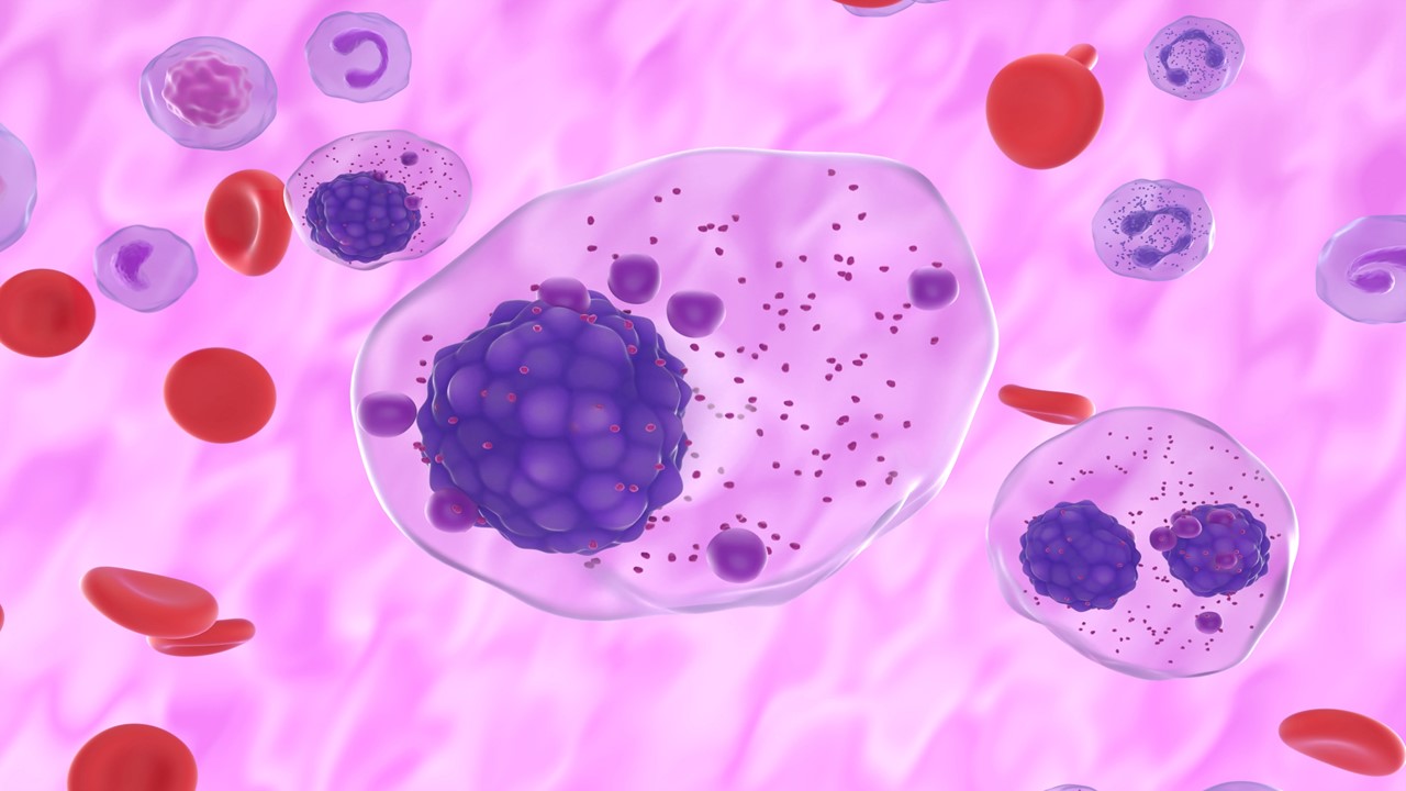 MM R/R: FDA aprueba de manera acelerada elranatamab, estudio MagnetisMM-3