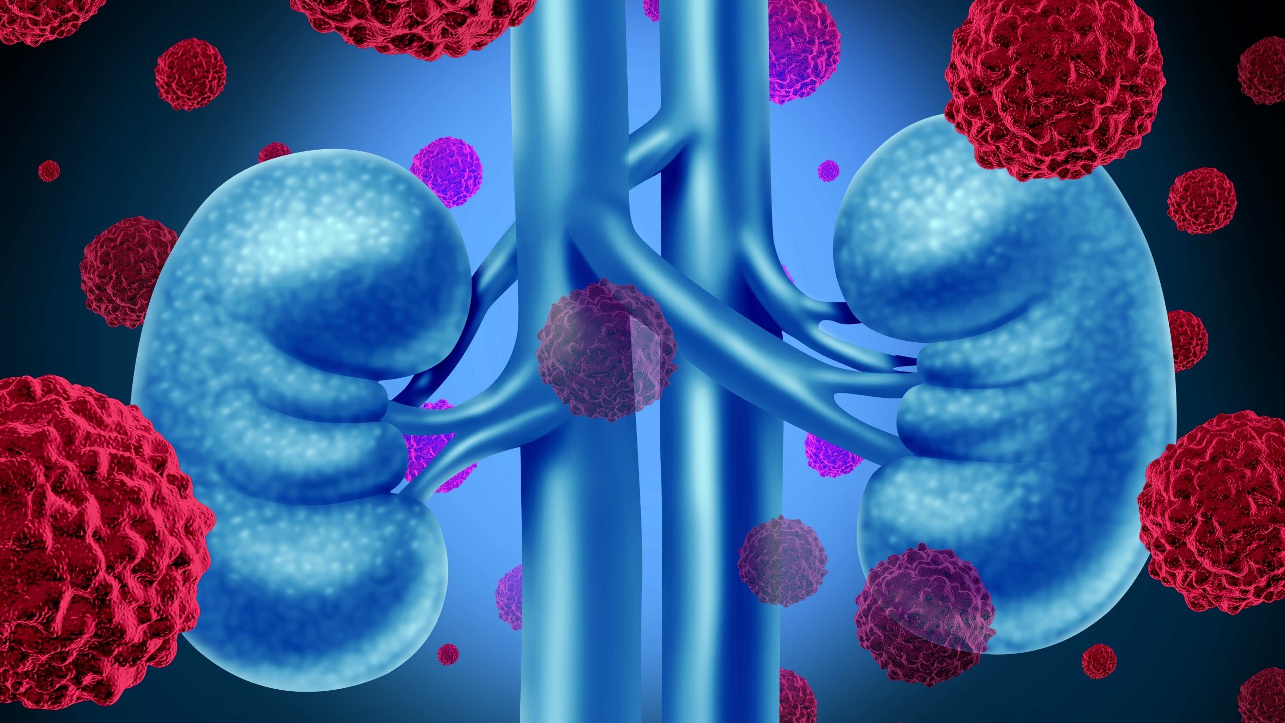 CCR avanzado: belzutifan cumplió su objetivo primario de SLP vs. everolimus, estudio LITESPARK-005