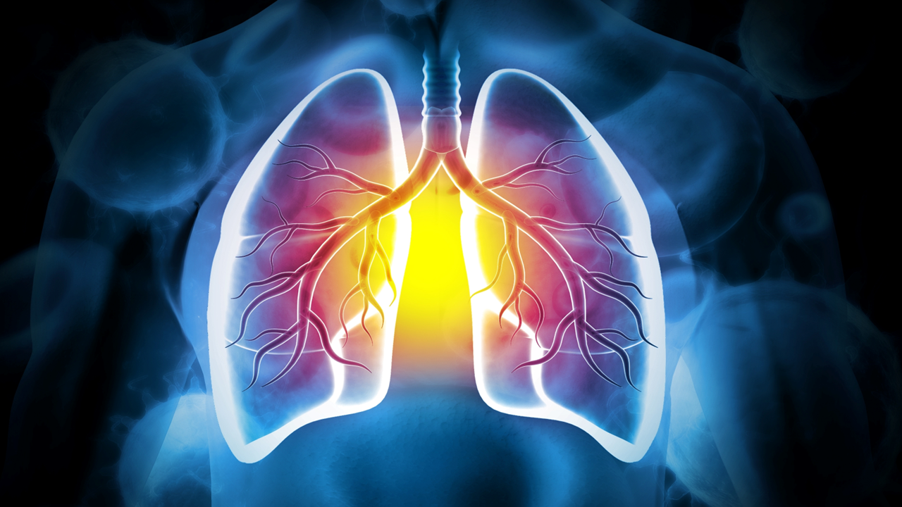 CPCNP EGFRm: amivantamab + lazertinib en 1L mejoran SLP, estudio MARIPOSA