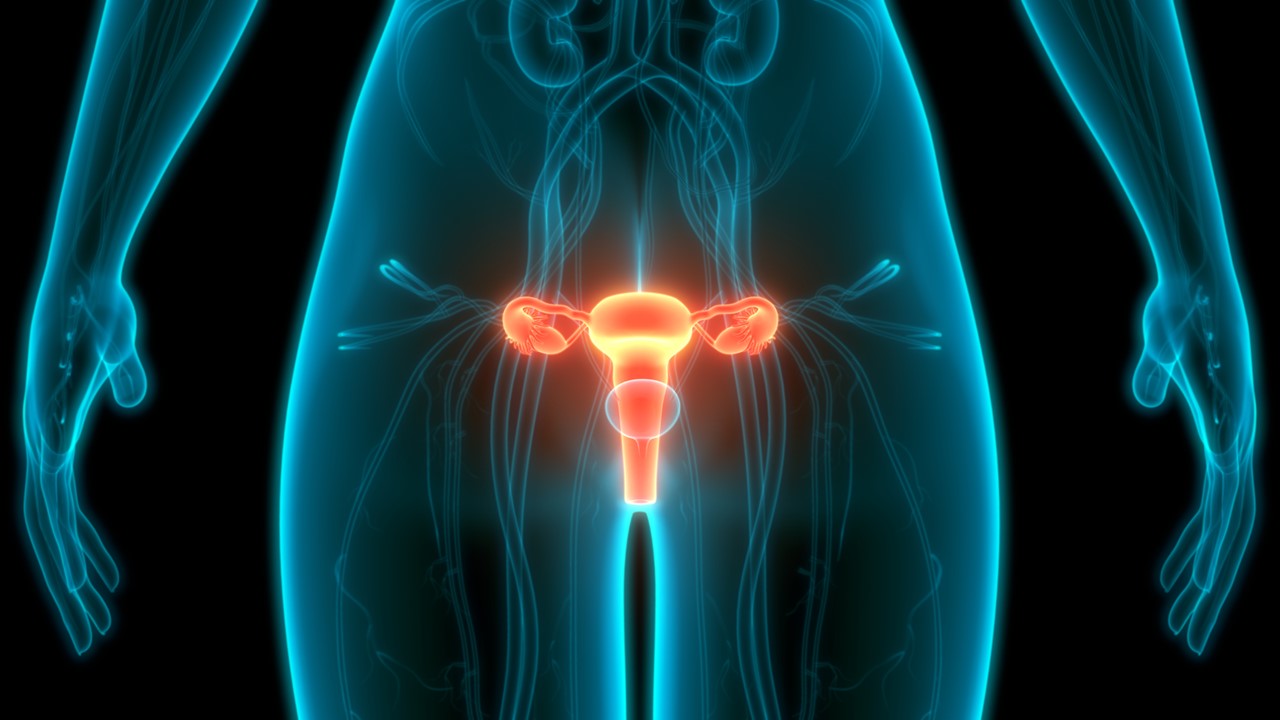 Cá. cervical recurrente o metastásico: tisotumab vedotin cumplió su objetivo de SG vs. QT sola, estudio innovaTV 301