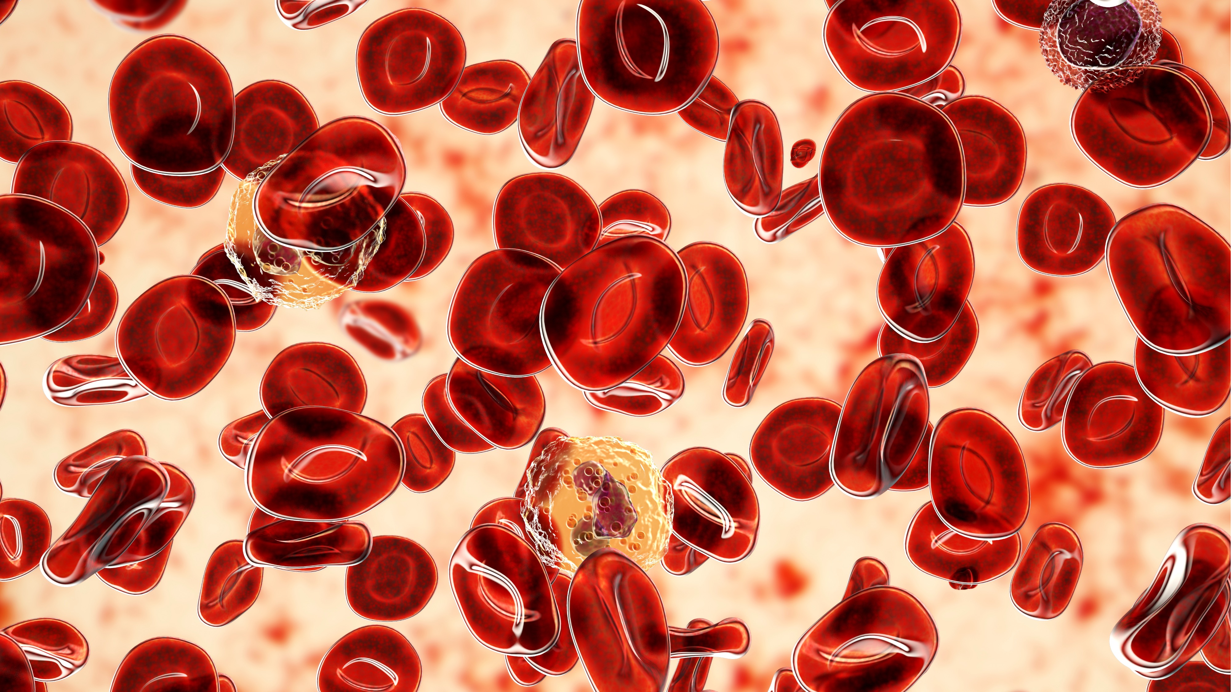 Mielofibrosis: FDA aprobó momelotinib para pacientes con anemia
