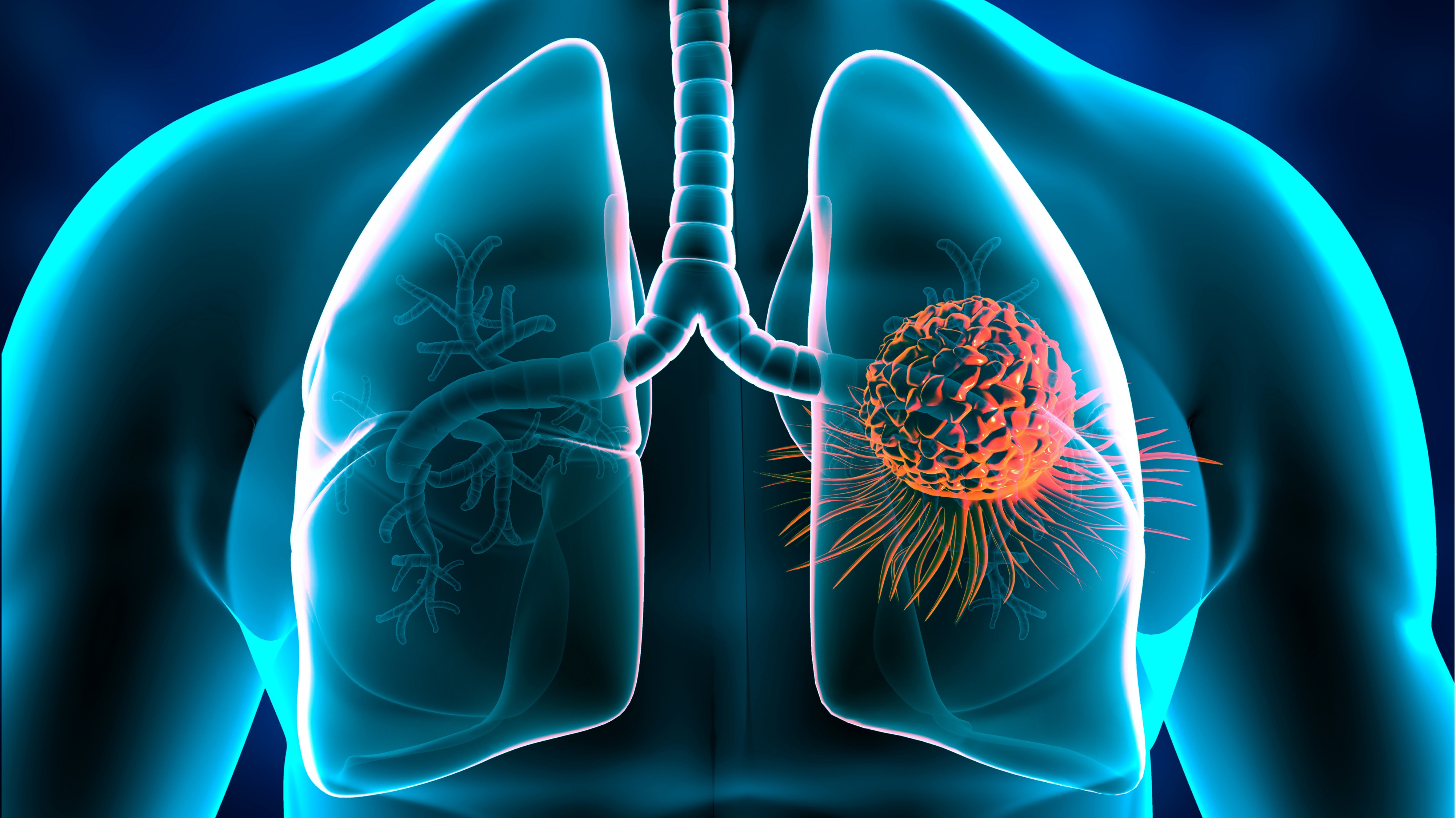 CPCNP: beneficio sostenido de nivolumab e ipilimumab en primera línea a 6 años de seguimiento, estudio CheckMate 227