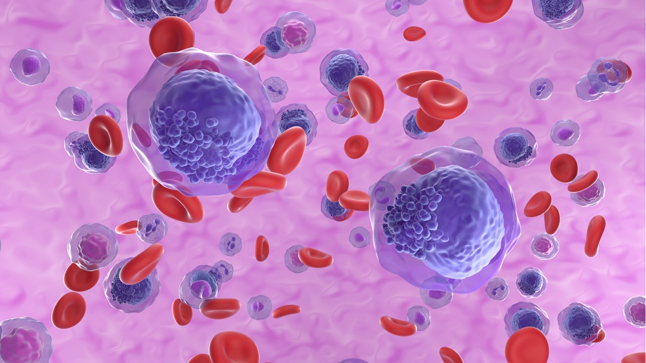LMA: quizartinib mejora la SG en diversos subgrupos, estudio QuANTUM-First