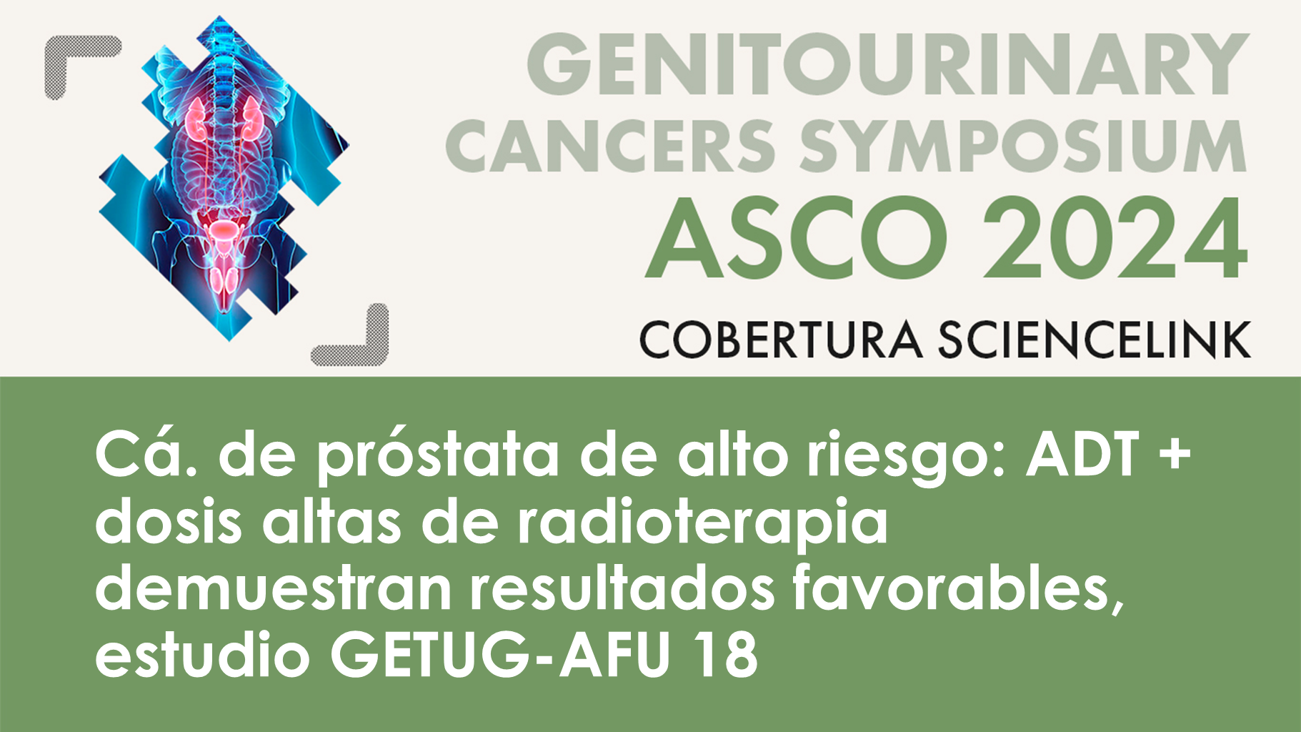 Cá. de próstata de alto riesgo: ADT + dosis altas de radioterapia demuestran resultados favorables, estudio GETUG-AFU 18