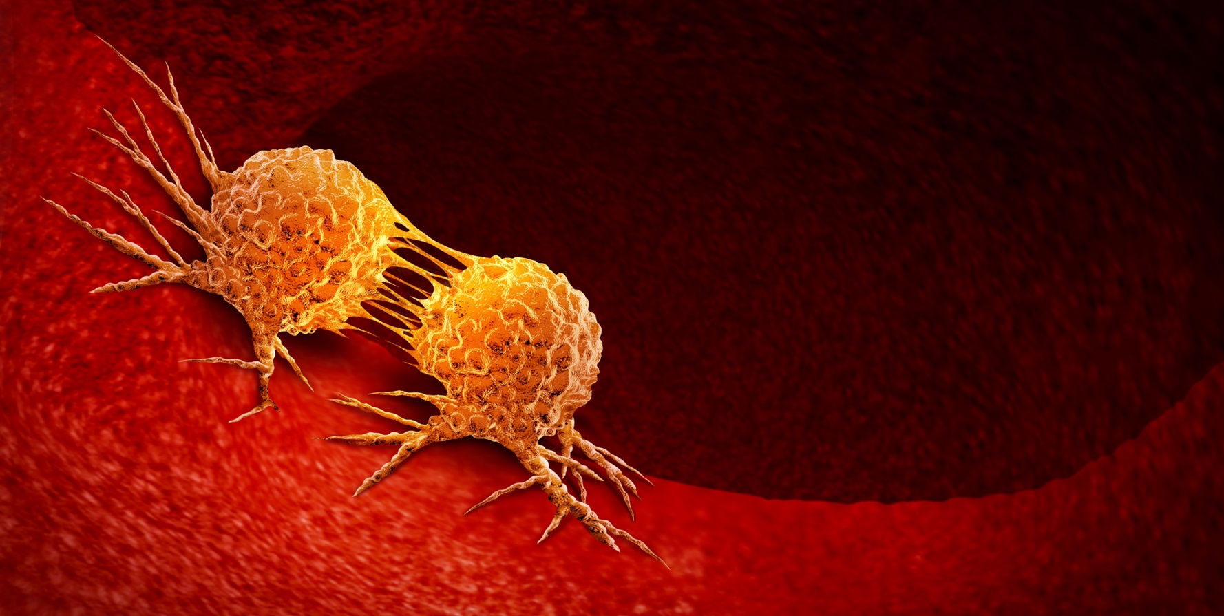 Tumores sólidos: biocomparable de denosumab demuestra equivalencia en estudio fase III