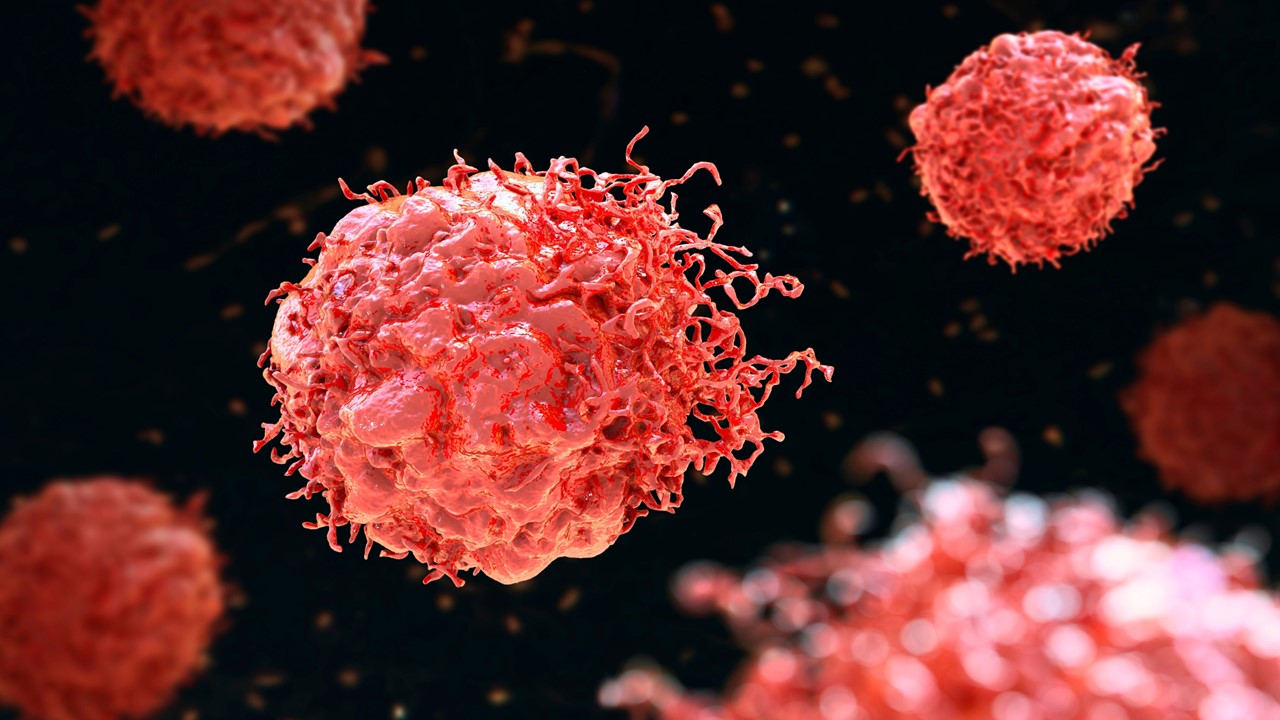 Cáncer de tiroides y tumores sólidos: FDA otorga aprobación acelerada a selpercatinib para pacientes pediátricos con tumores alterados por RET