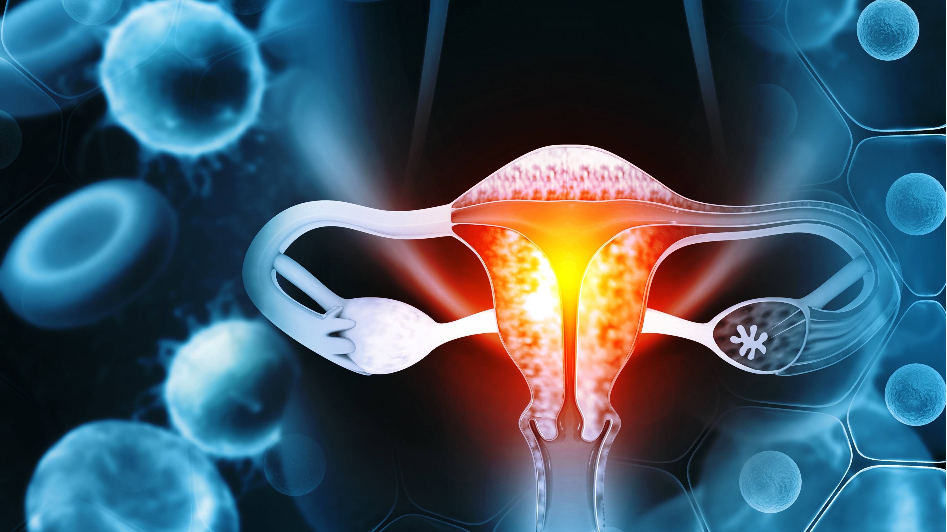 Cáncer de endometrio: la combinación de pembrolizumab genera beneficios en supervivencia, estudio NRG-GY018/KEYNOTE-868