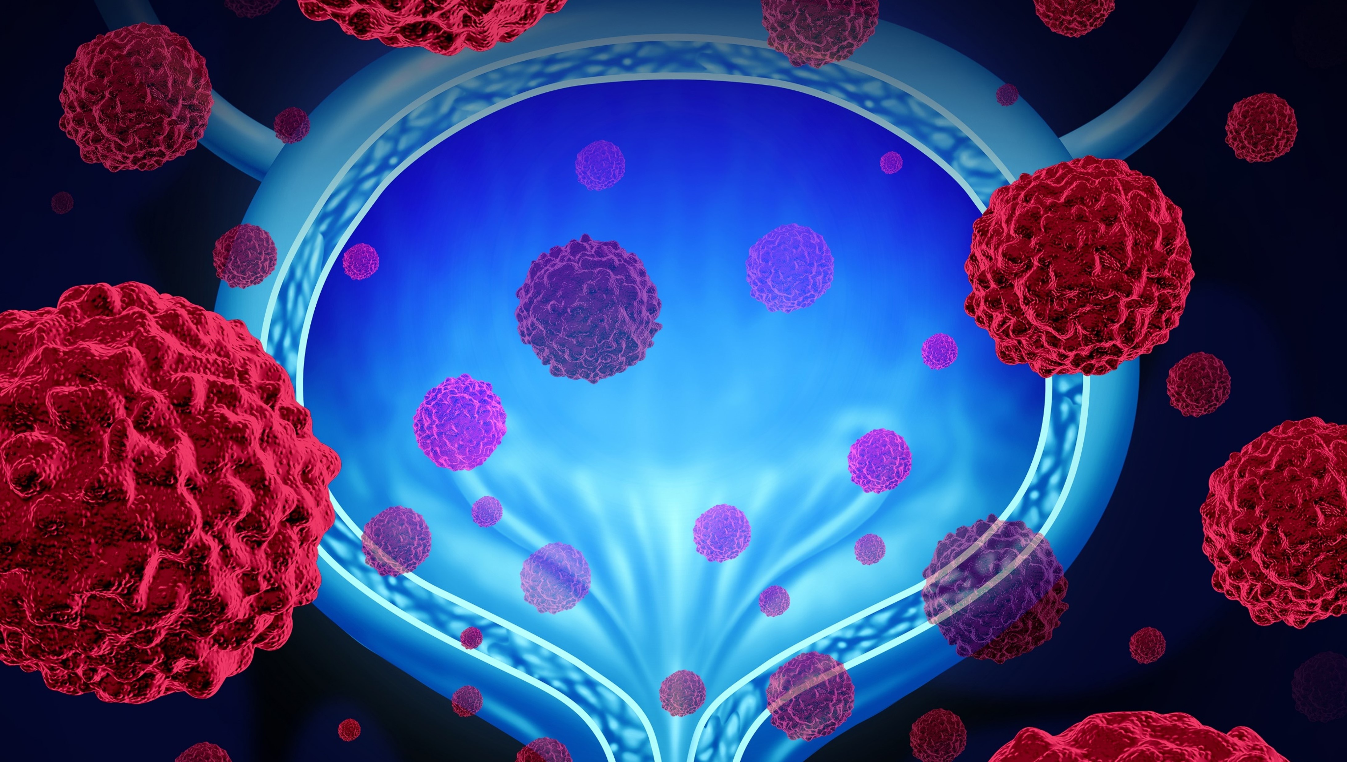 Cá. de vejiga no músculo invasivo no respondedor a BCG: la FDA aprueba nogapendekin alfa inbakicept-pmln + BCG, estudio QUILT-3.032