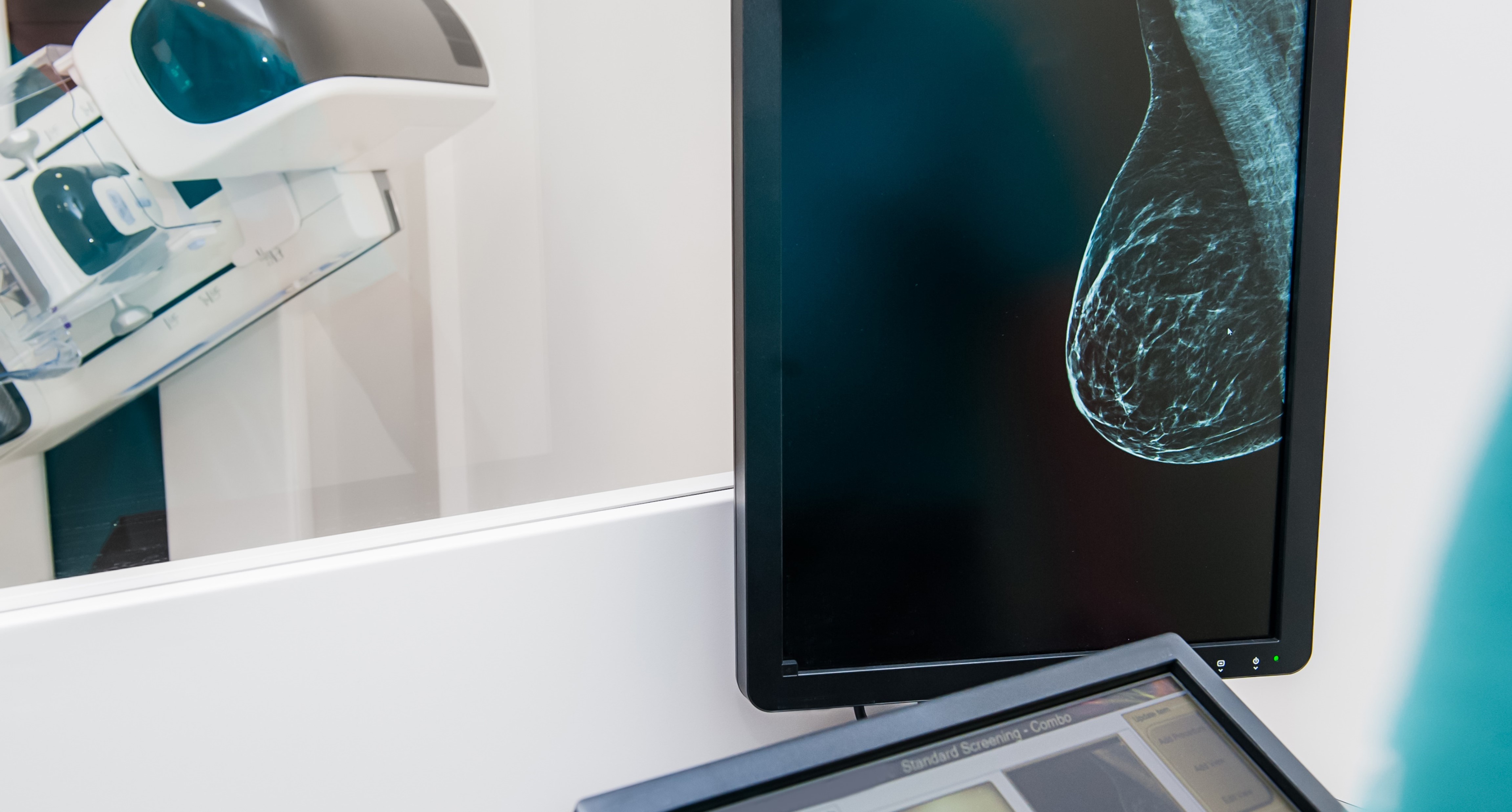 La FDA aprueba pegulicianina para la detección de tejido canceroso después de una tumorectomía