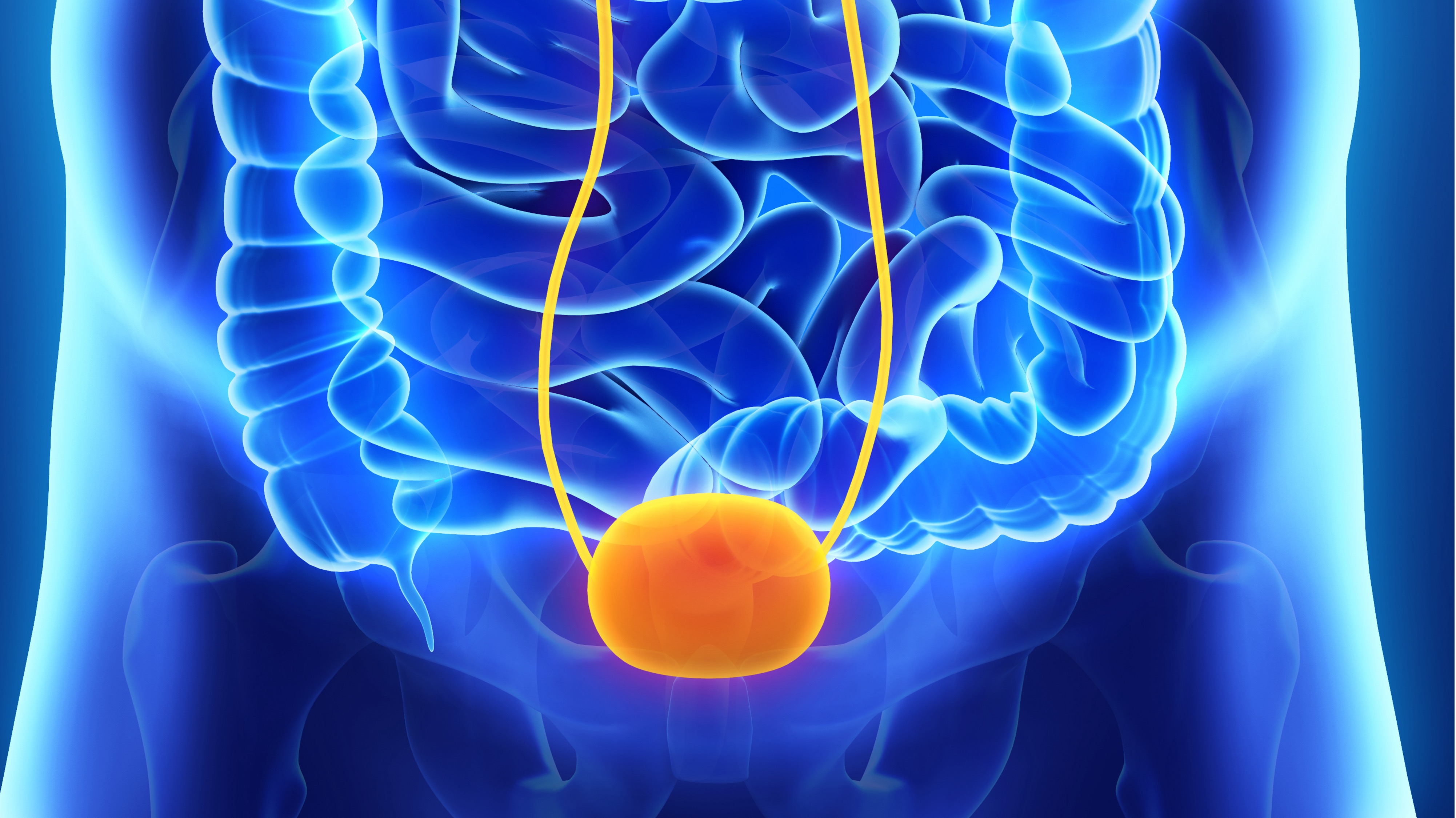 Cáncer de vejiga invasivo: resultados alentadores con prueba de detección, estudio IMvigor011