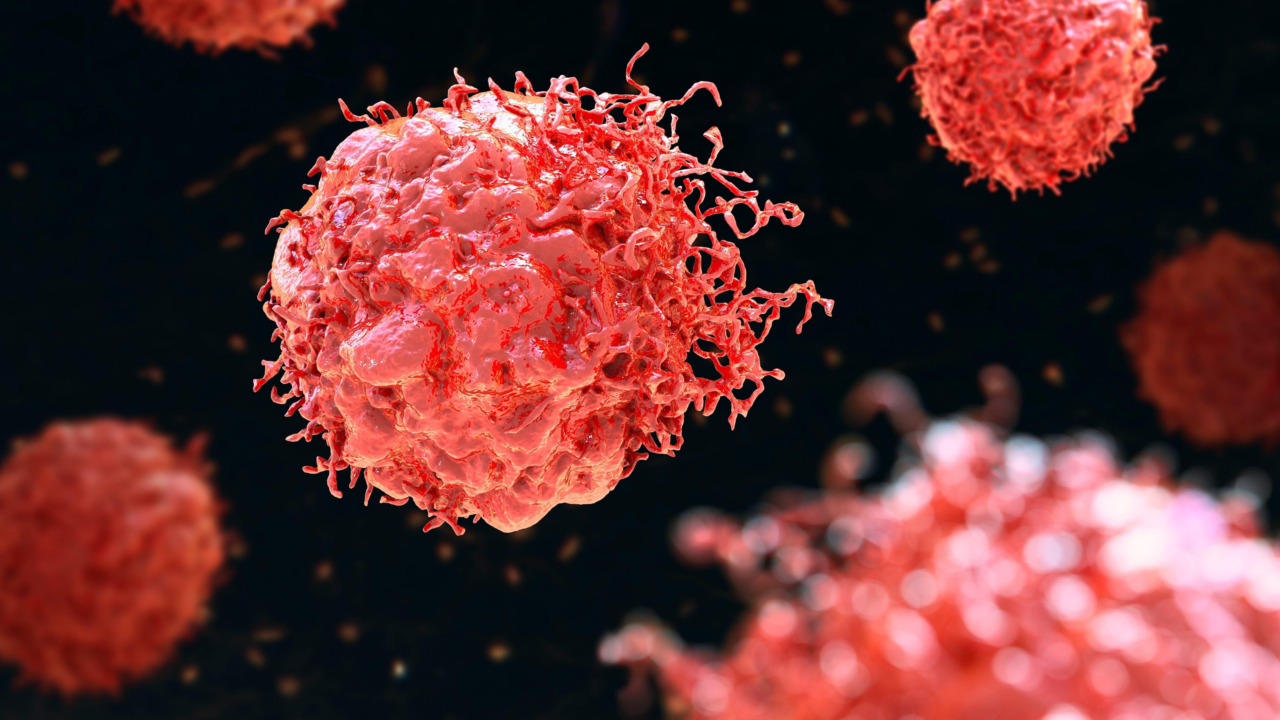 Cá. de vías biliares y hepatocarcinoma no resecable: durvalumab recibe aprobación en México