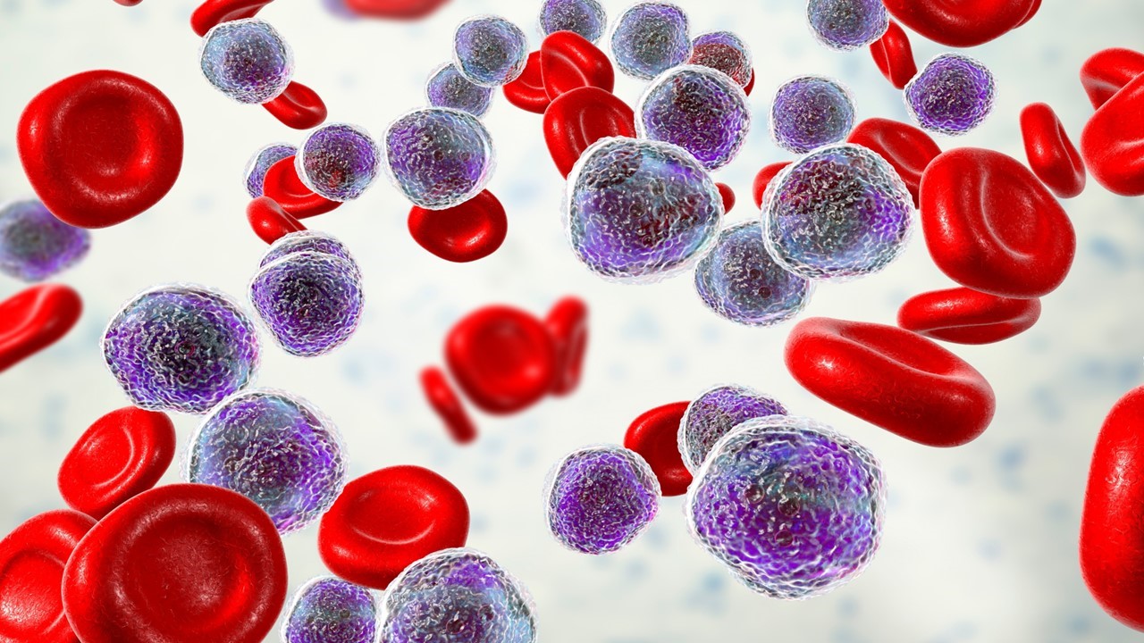 LLA de células B CD19+: la FDA aprueba blinatumomab para fase de consolidación, estudio ECOG-ACRIN E1910