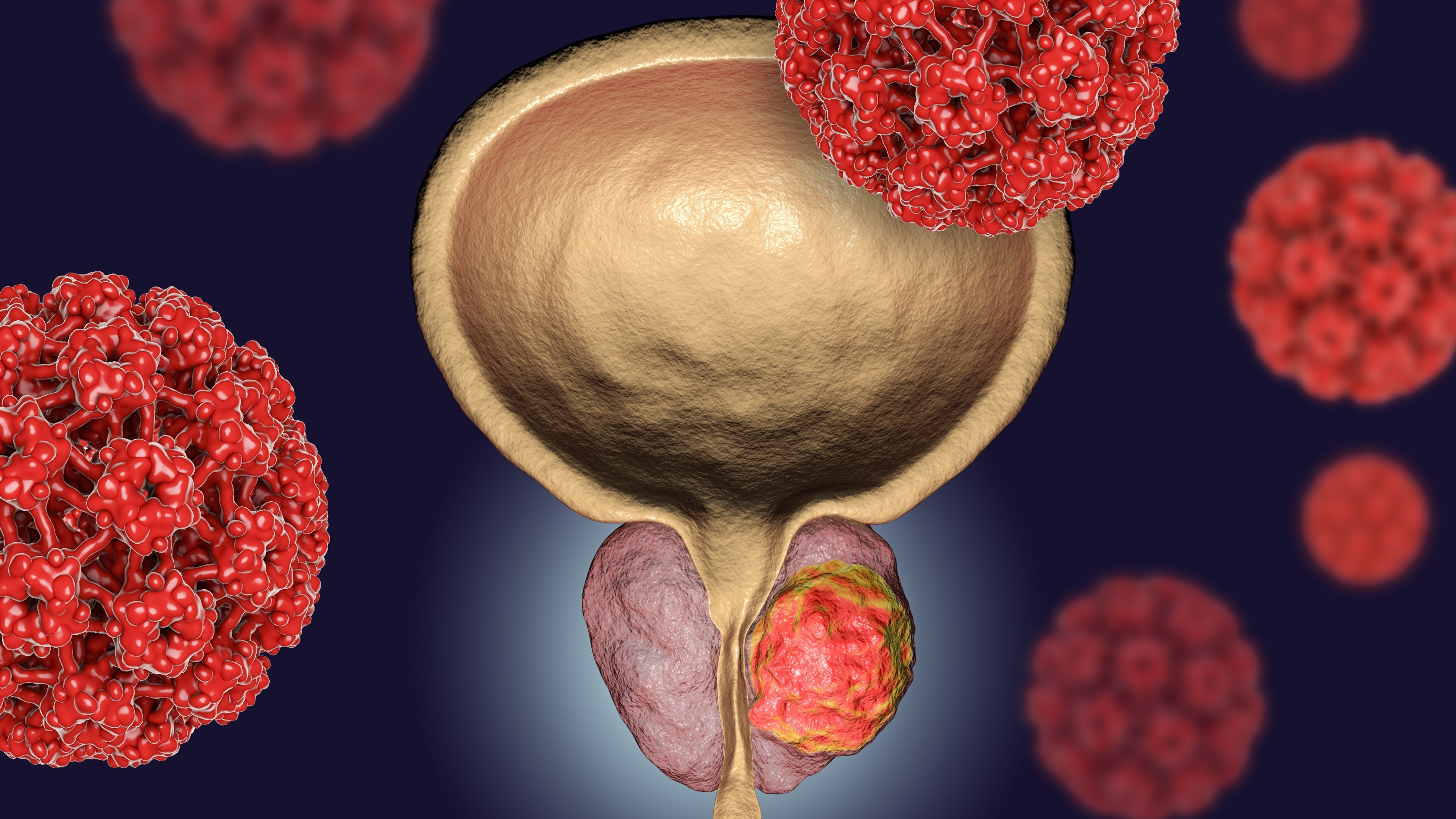 CPRCm BRCA+: la FDA aprueba FoundationOne®Liquid CDx como diagnóstico de acompañamiento de niraparib + abiraterona en un comprimido