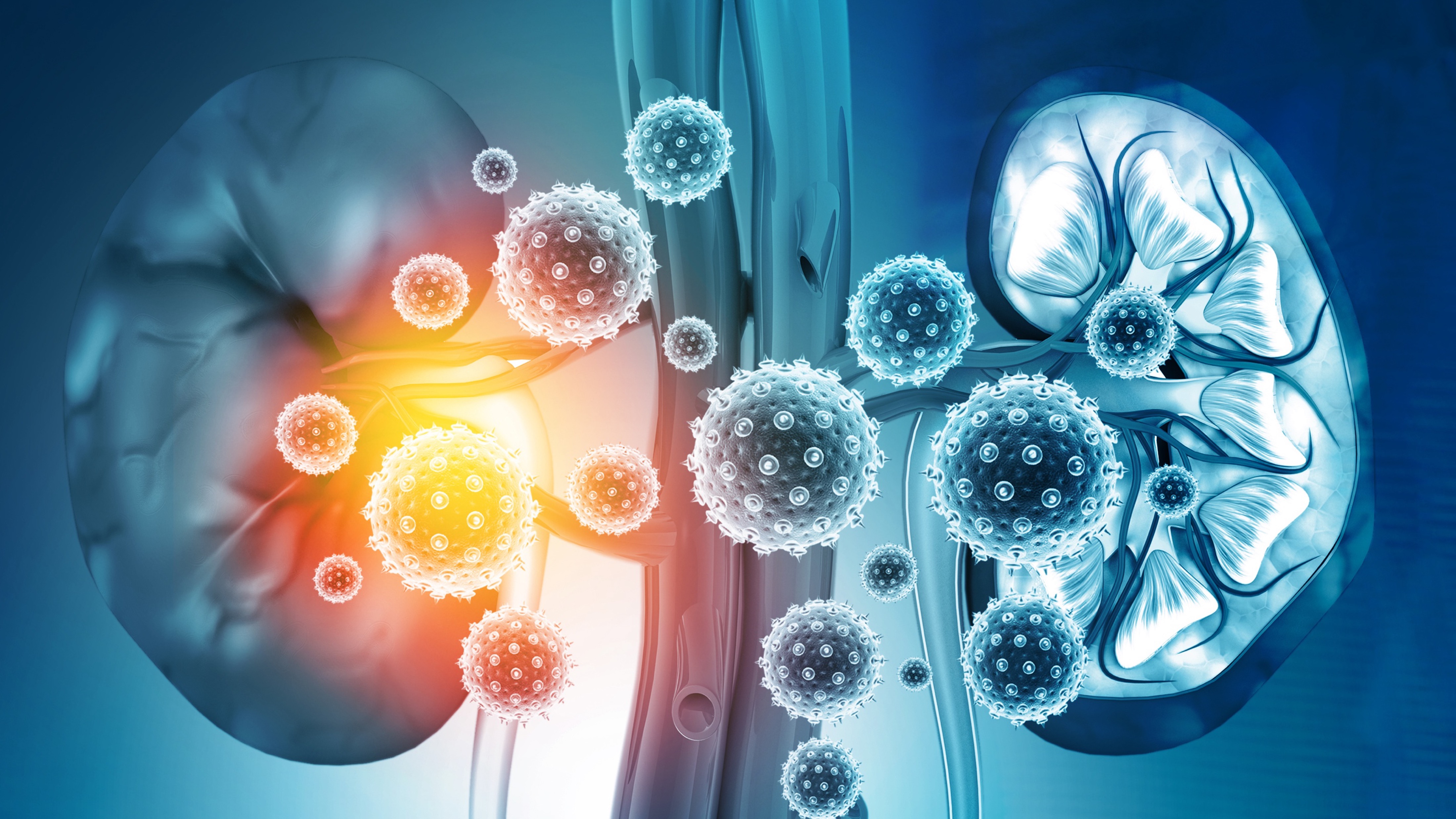 CCR avanzado: resultados del estudio TiNivo-2 de tivozanib con y sin nivolumab