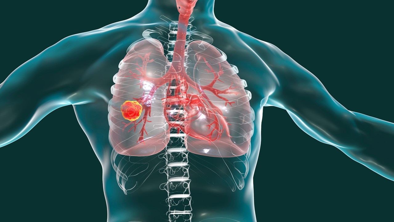 CPCP: FDA otorgó la designación de medicamento huérfano a 7MW3711