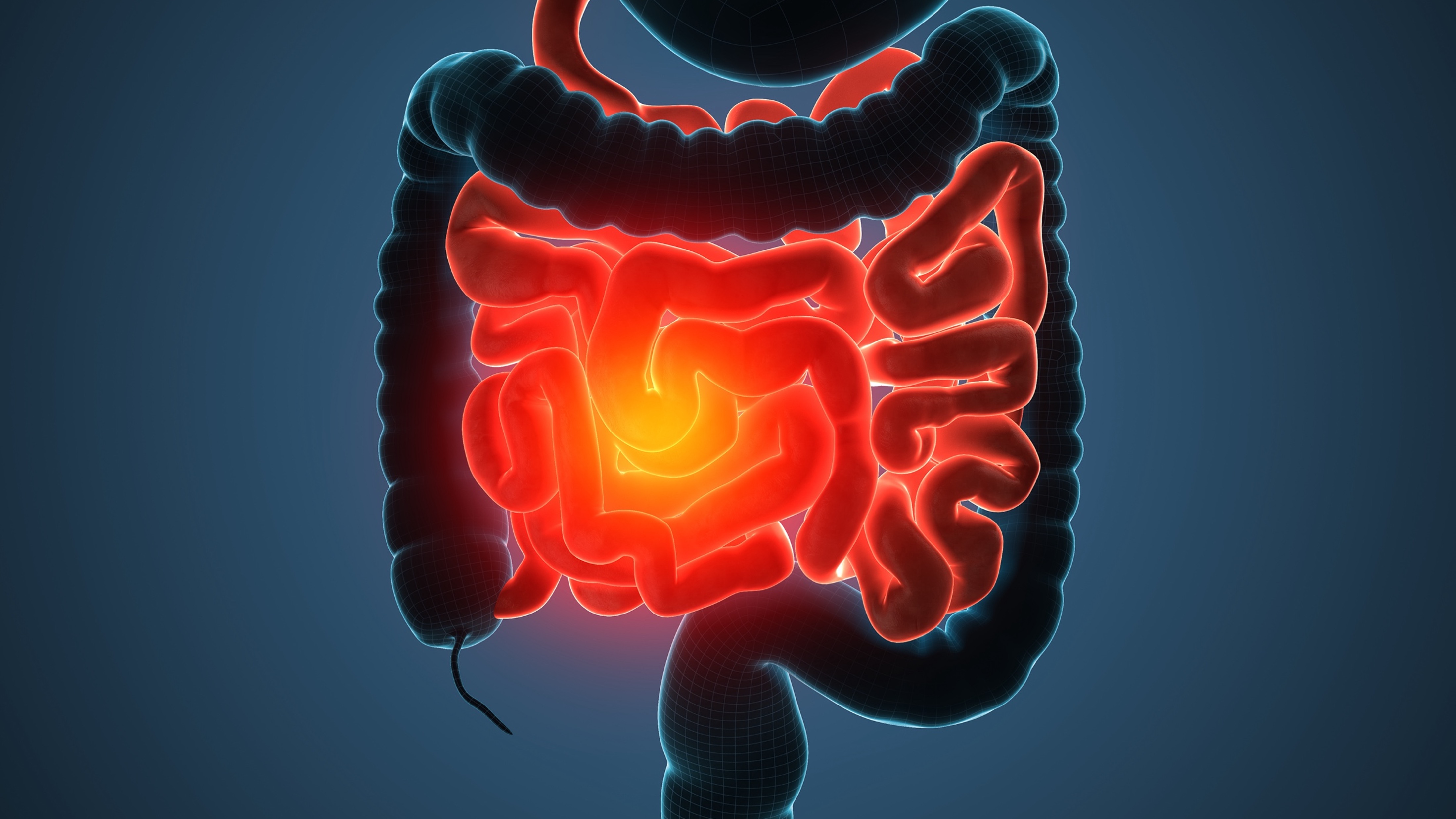 CCRm RAS y BRAF wt: actualización en las recomendaciones de 1L en tumores del lado izquierdo, guías ESMO