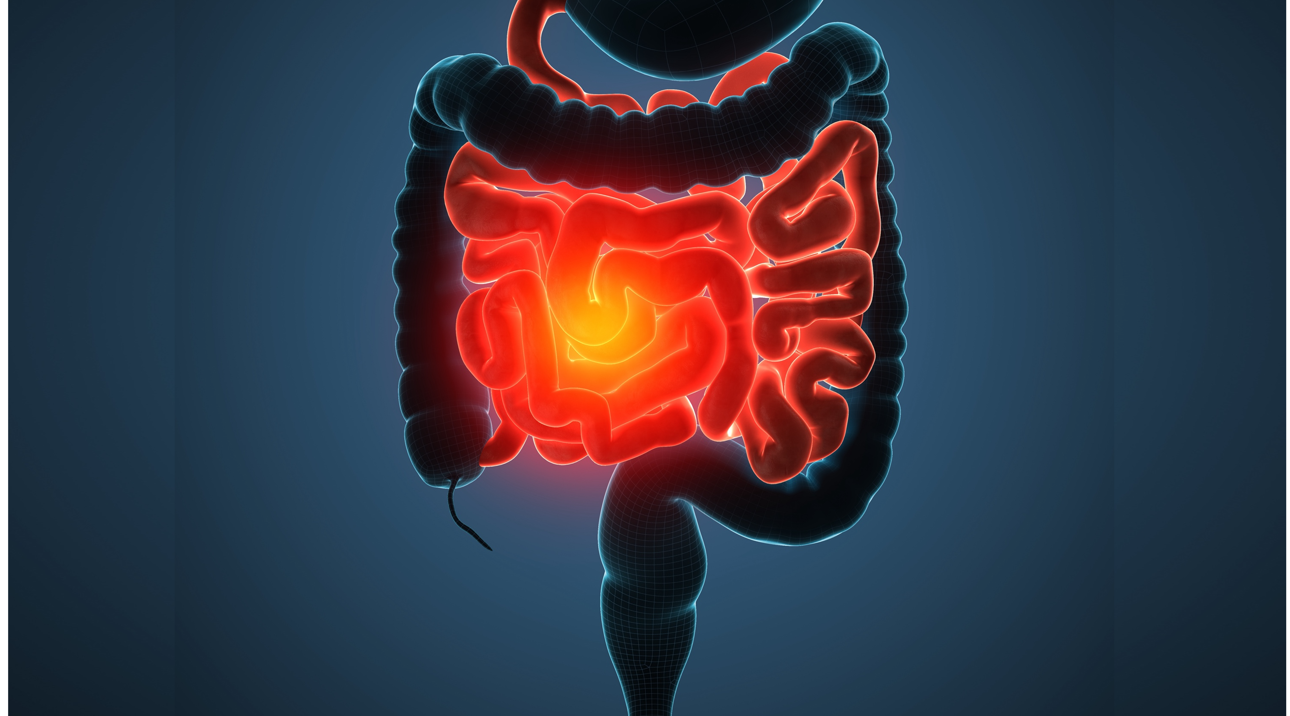 CCRm MSI-H o dMMR: nivolumab más ipilimumab superan a la QT en pacientes no tratados previamente, estudio CheckMate 8HW