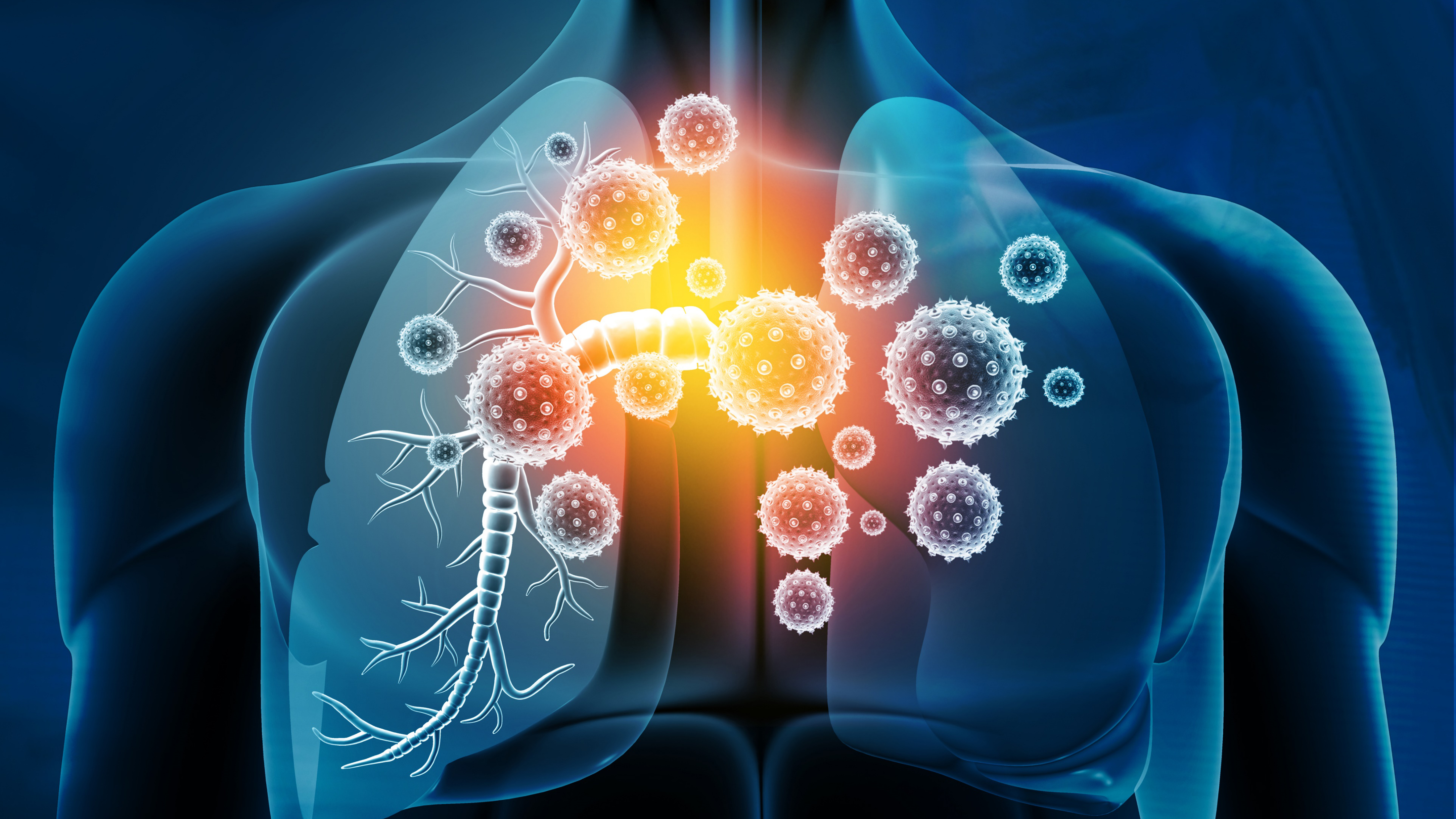 CPCNP: la FDA ha aprobado el uso de FoundationOne Liquid CDx como diagnóstico complementario para tepotinib